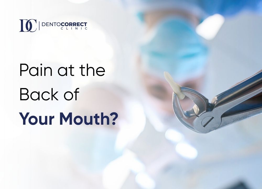 Dental extraction forceps, wisdom tooth removal in Faisalabad