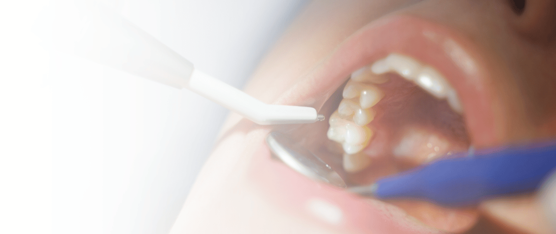 Dentist performing teeth scaling and polishing in Faisalabad at DentoCorrect clinic