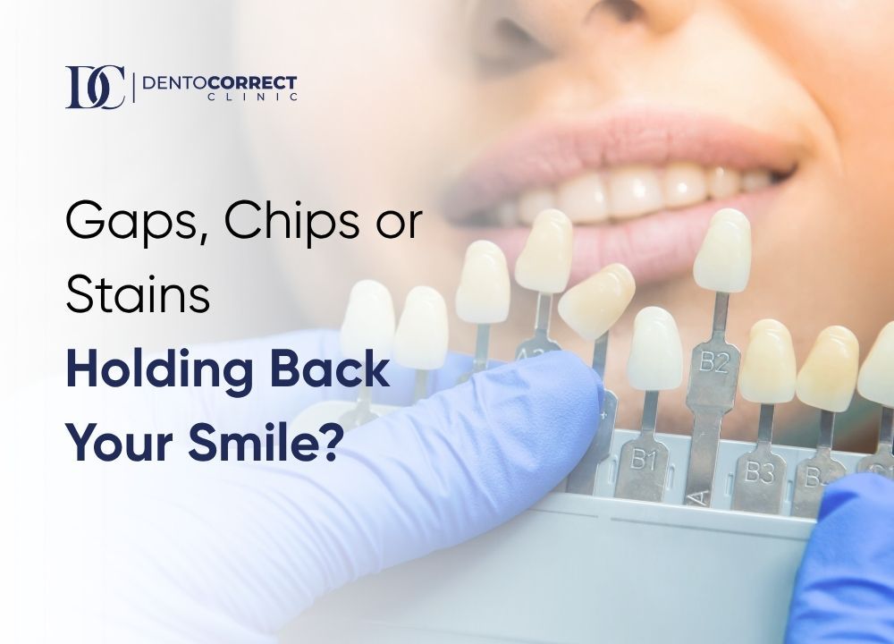 Dental veneers in Peshawar for gaps, chips and crooked teeth