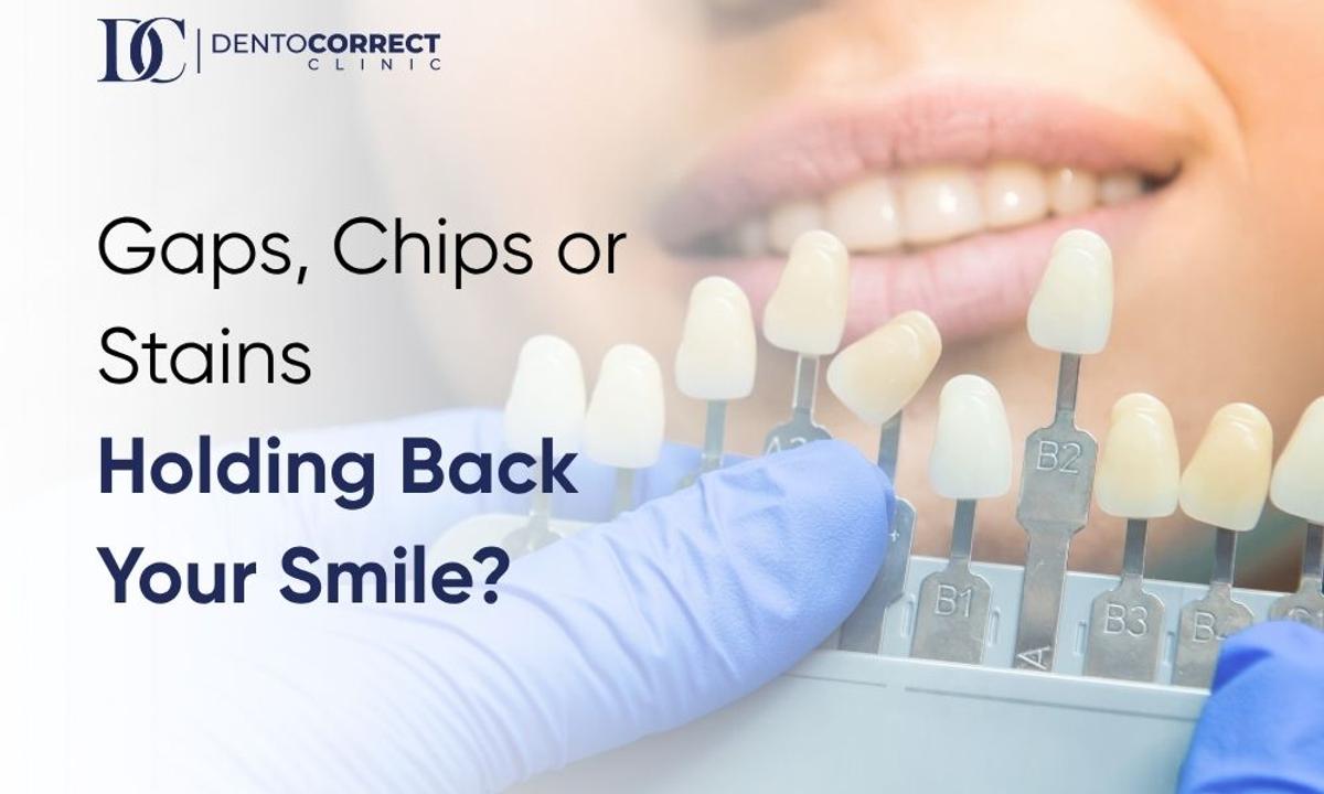 Dental veneers in Peshawar for gaps, chips and crooked teeth