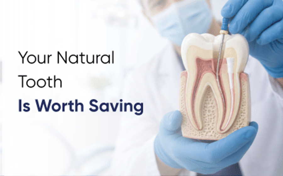 Root canal treatment in Lahore: dentist holding a cross-section model of a tooth showing the root canal