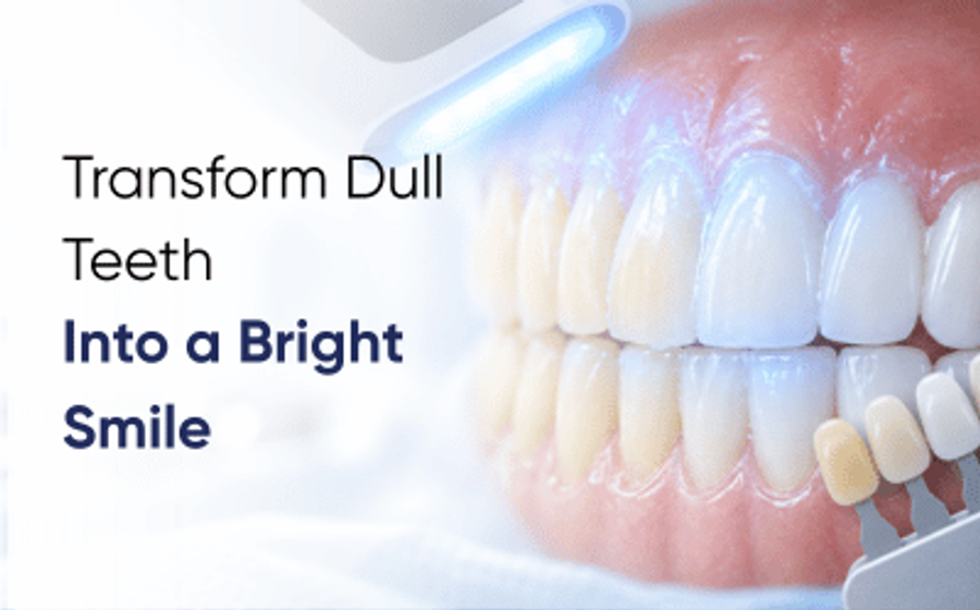 Professional teeth whitening in Rawalpindi with a shade guide at DentoCorrect Bahria Town