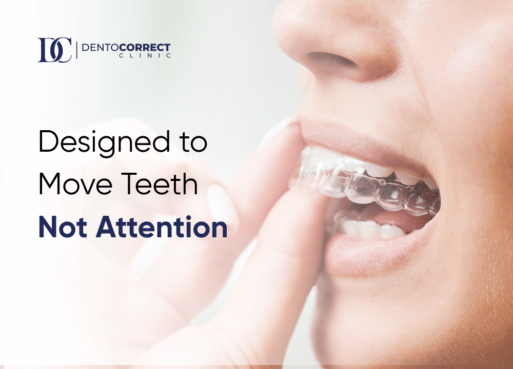 Clear aligners in Rawalpindi designed to move teeth, not attention