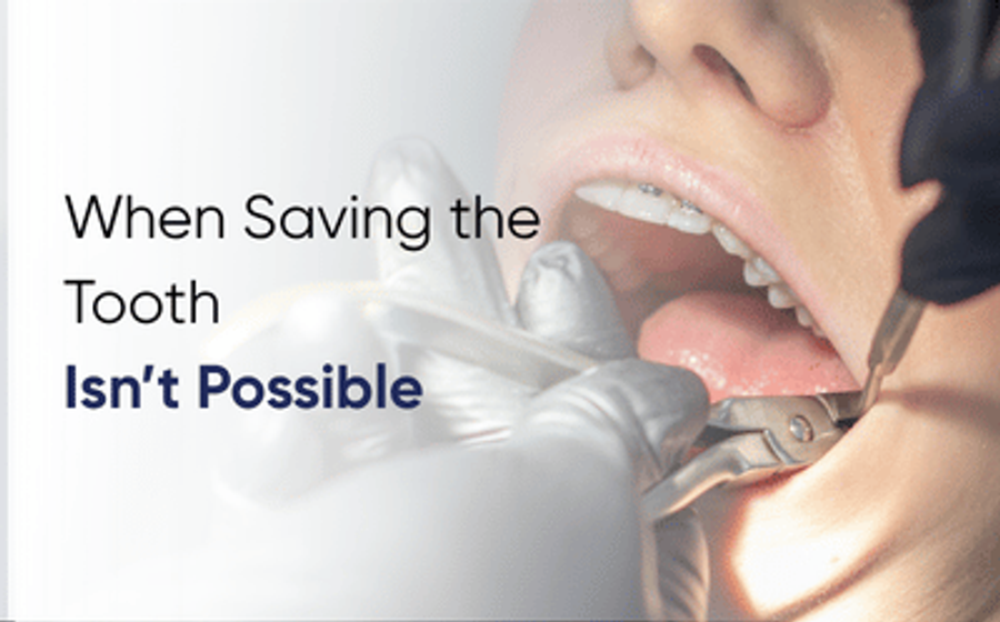 Dentist carrying out a tooth extraction in Lahore at DentoCorrect clinic