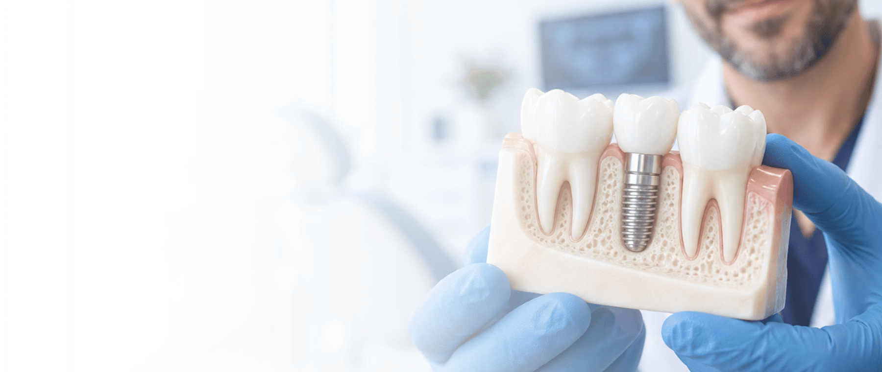 Dental implants in Peshawar: dentist holding a model showing an implant placed in the jawbone