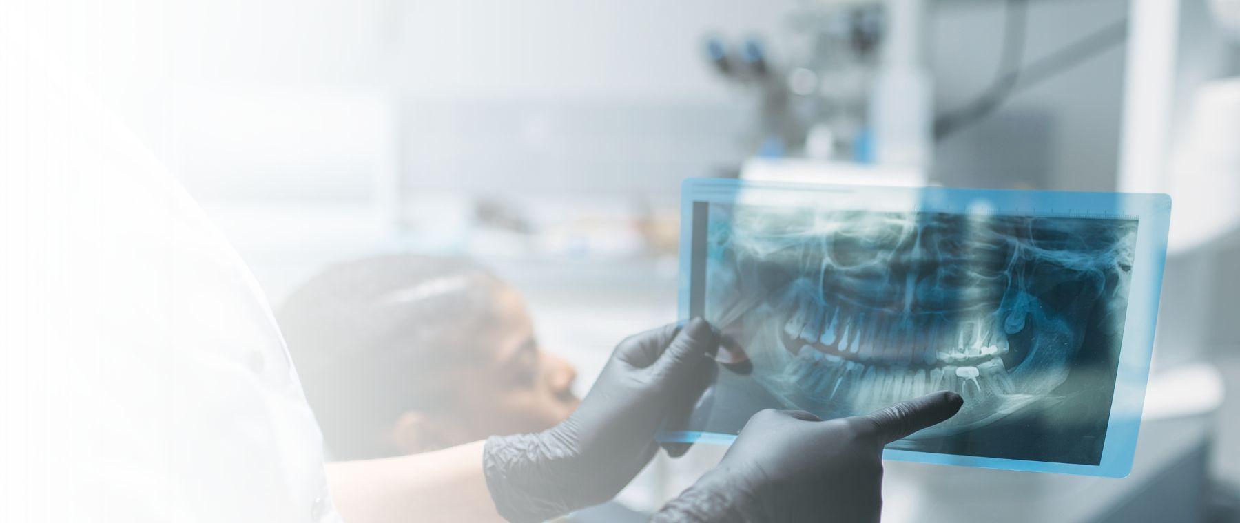 Dentist reviewing an X-ray before root canal treatment in Rawalpindi