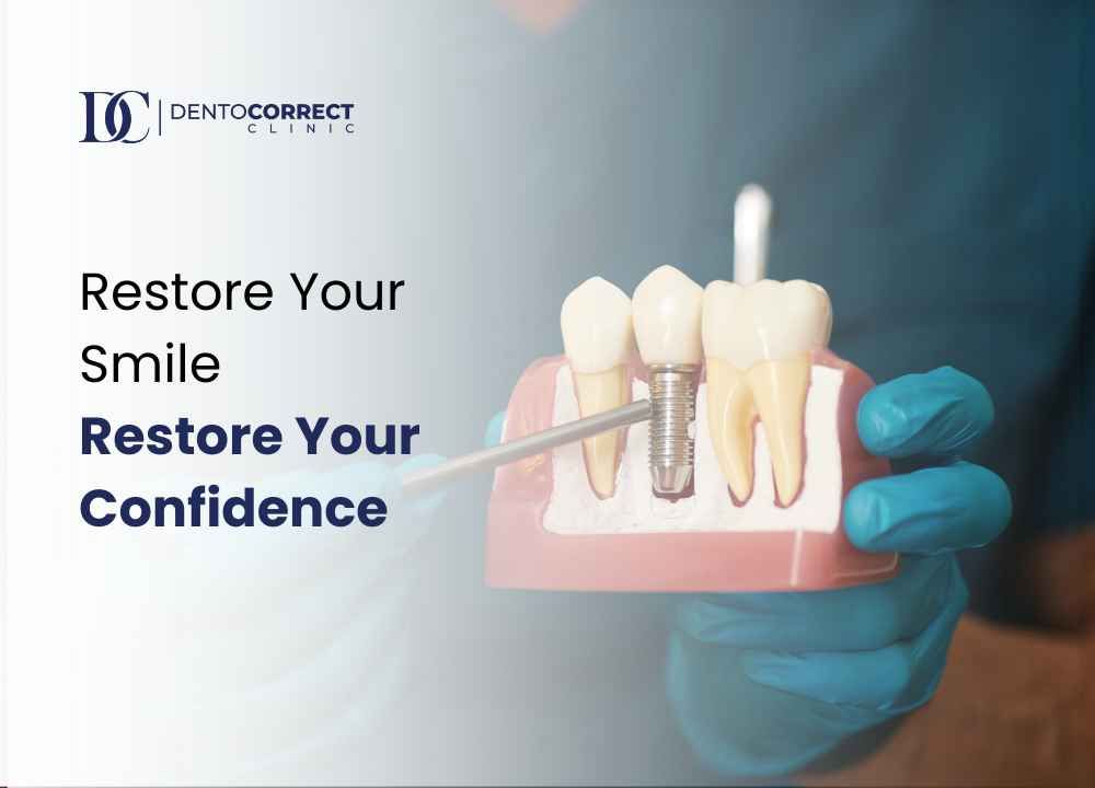 Dental implants in Karachi at DentoCorrect: restore your smile and confidence