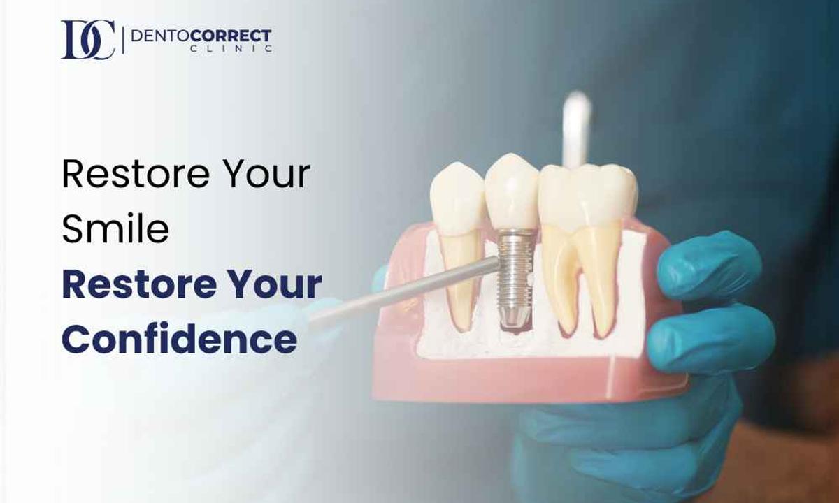 Dental implants in Karachi at DentoCorrect: restore your smile and confidence