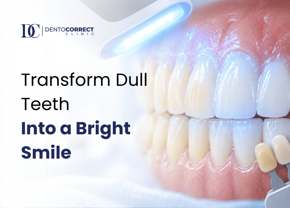 Teeth whitening in Rawalpindi: transform dull teeth into a bright smile