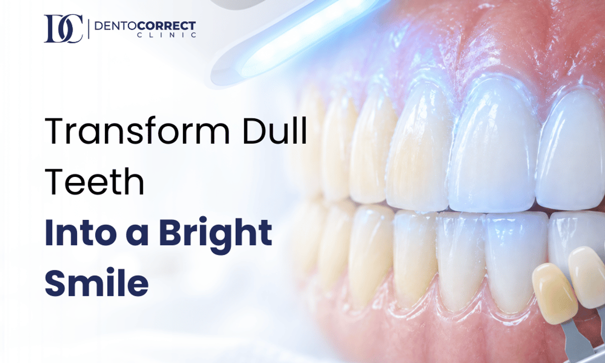 Teeth whitening in Rawalpindi: transform dull teeth into a bright smile