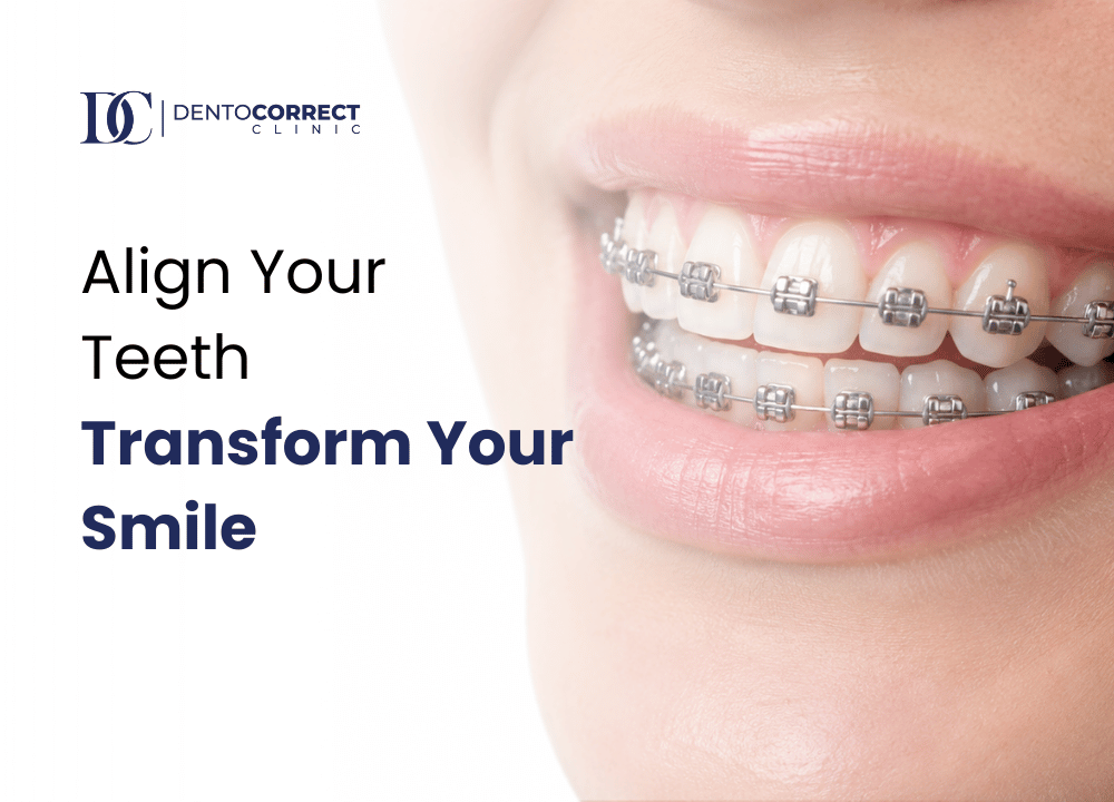 Braces price in Pakistan 2026 – metal braces close-up