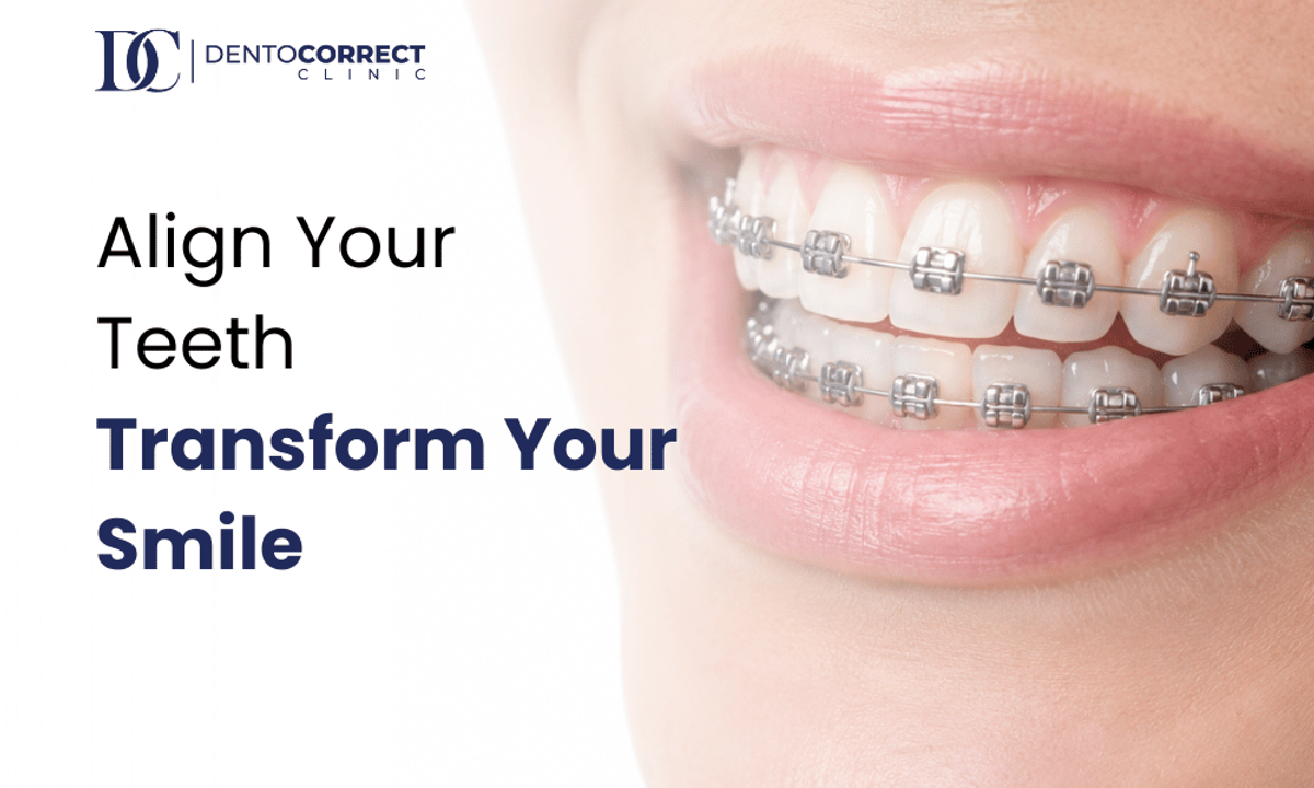 Braces price in Pakistan 2026 – metal braces close-up
