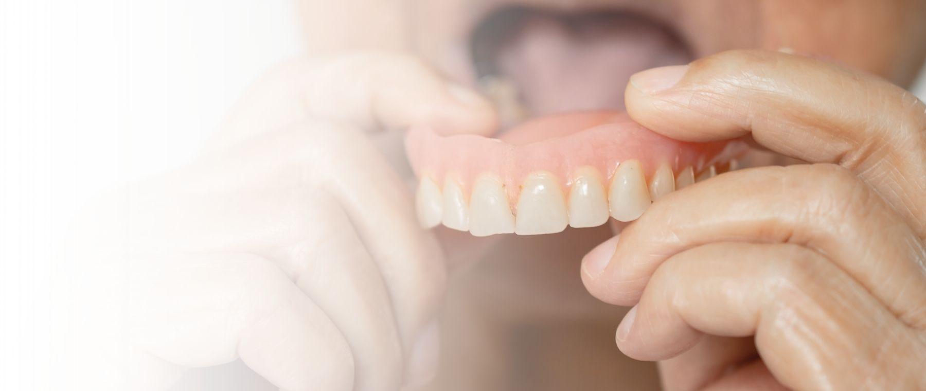 Dentures in Peshawar being fitted for an older patient at DentoCorrect