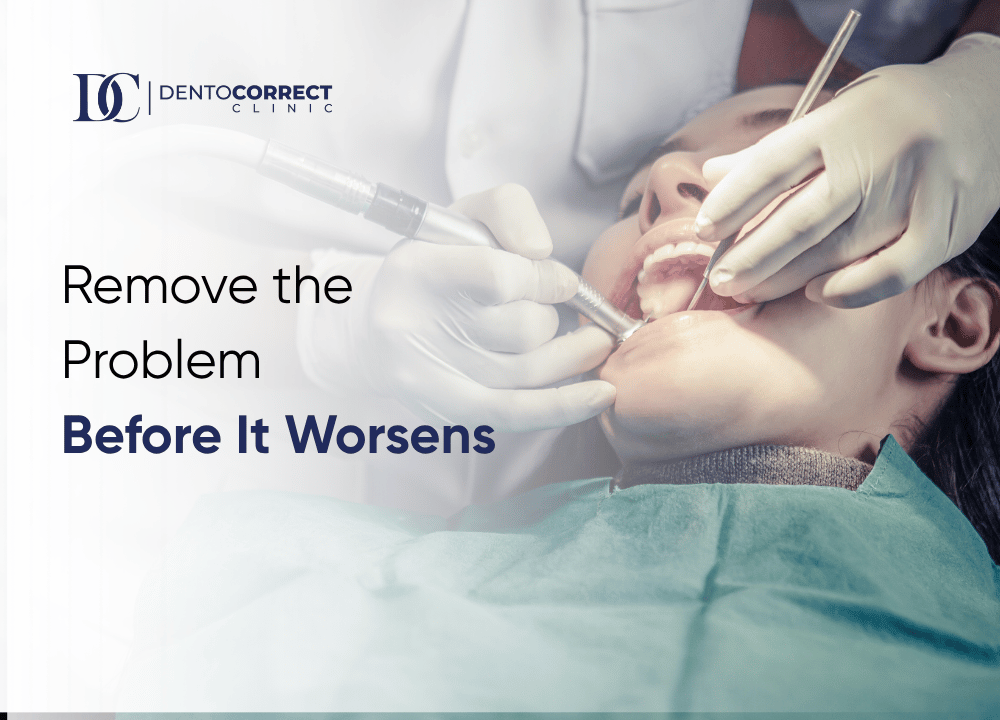 Wisdom tooth removal in Peshawar - remove the problem before it worsens