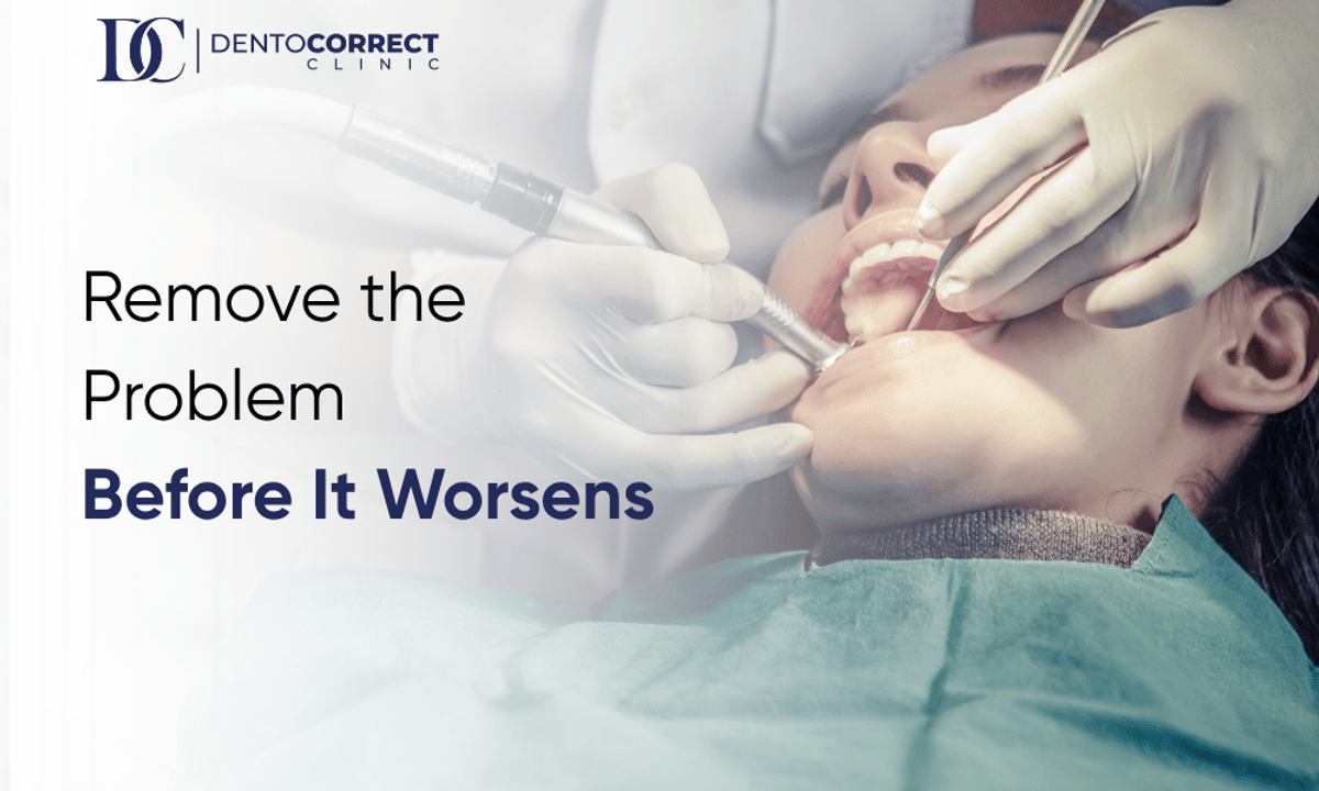 Wisdom tooth removal in Peshawar - remove the problem before it worsens