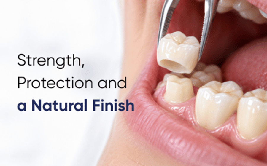 Dentist placing a ceramic crown during dental crowns in Lahore treatment at DentoCorrect