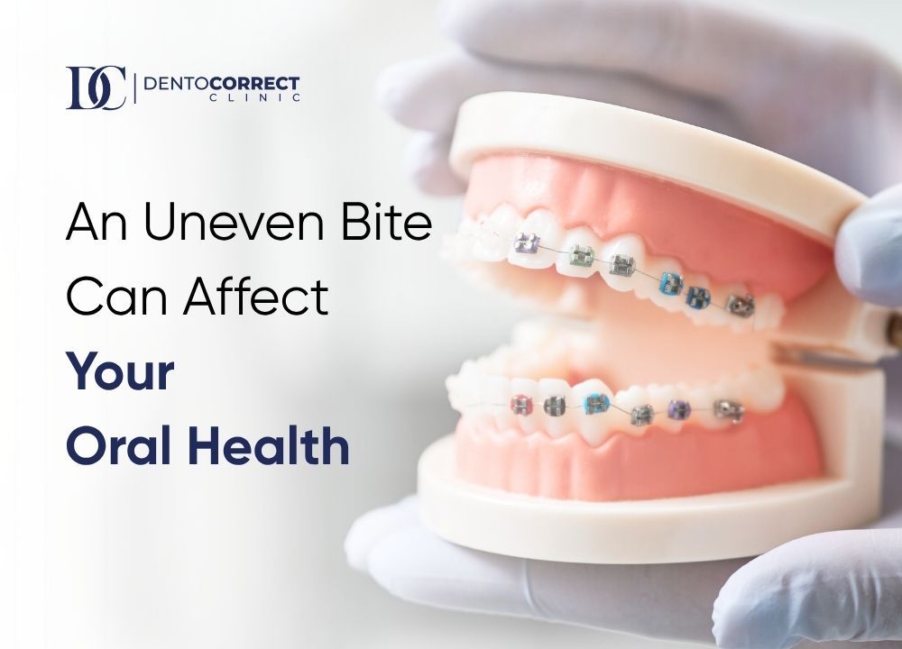 Teeth braces in Multan for adults with an uneven bite