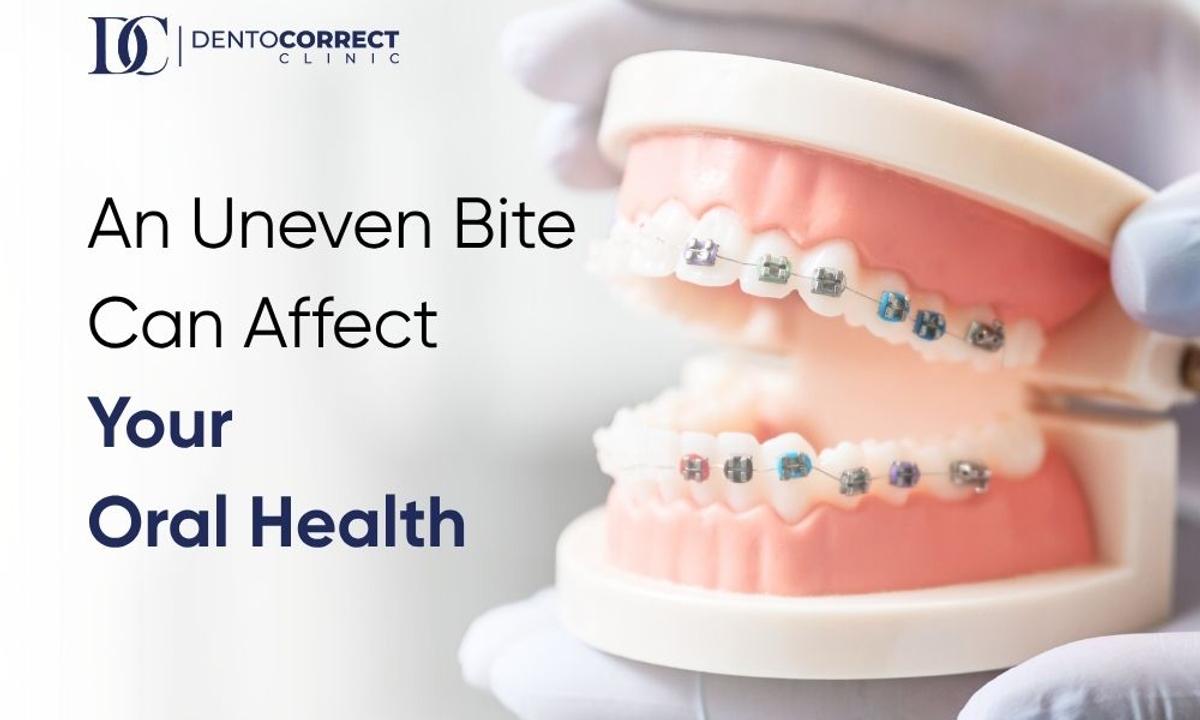 Teeth braces in Multan for adults with an uneven bite