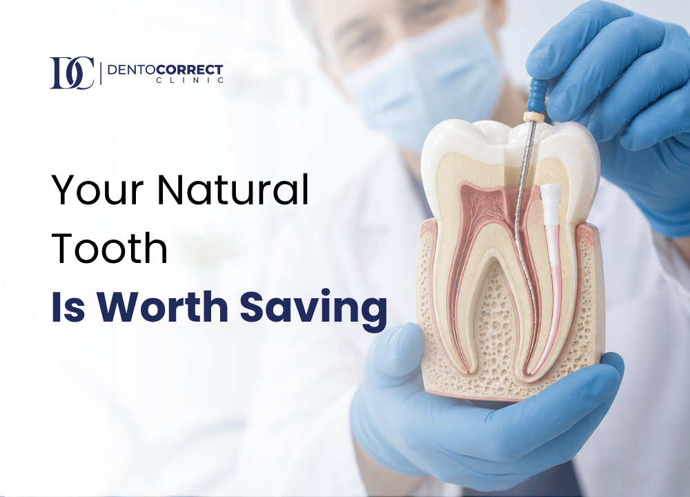 Root canal treatment in Lahore at DentoCorrect, Gulberg, Johar Town and DHA Phase 4