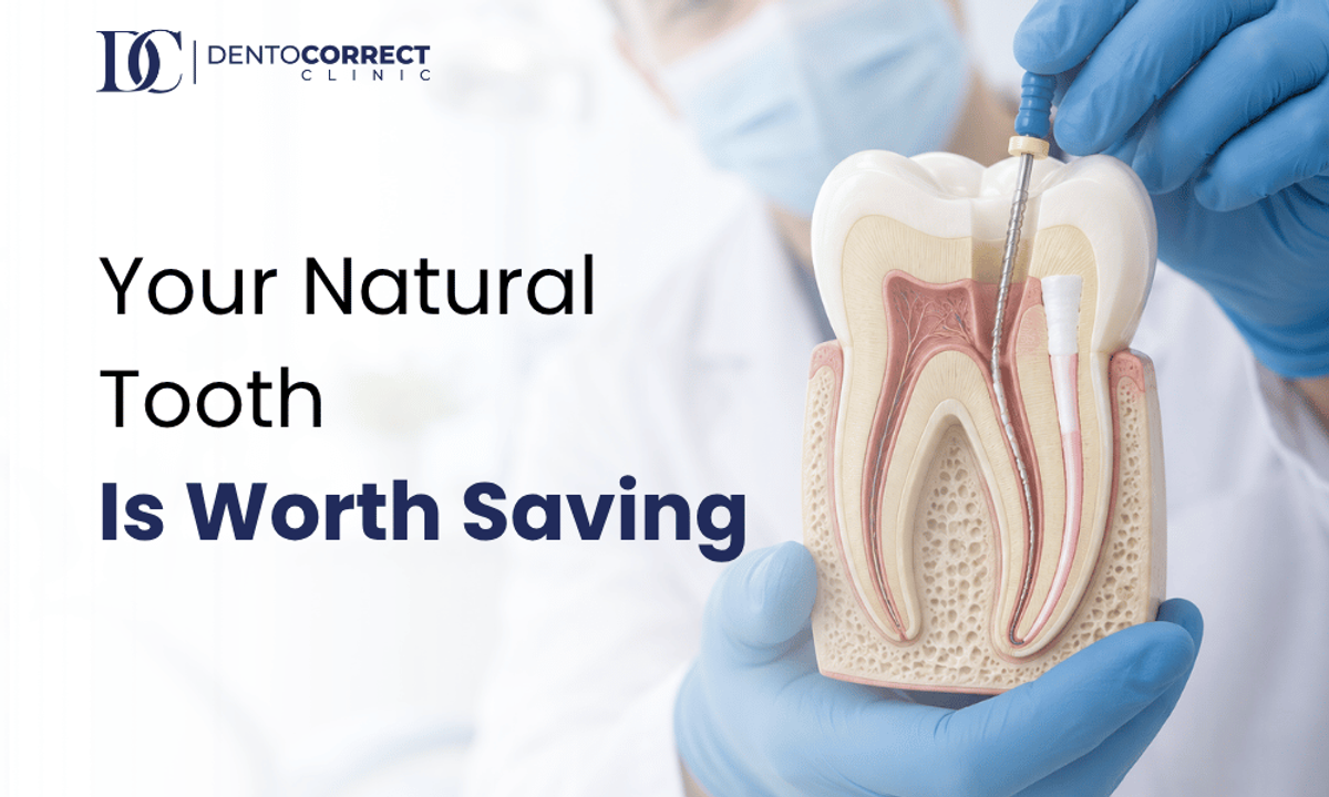 Root canal treatment in Lahore at DentoCorrect, Gulberg, Johar Town and DHA Phase 4
