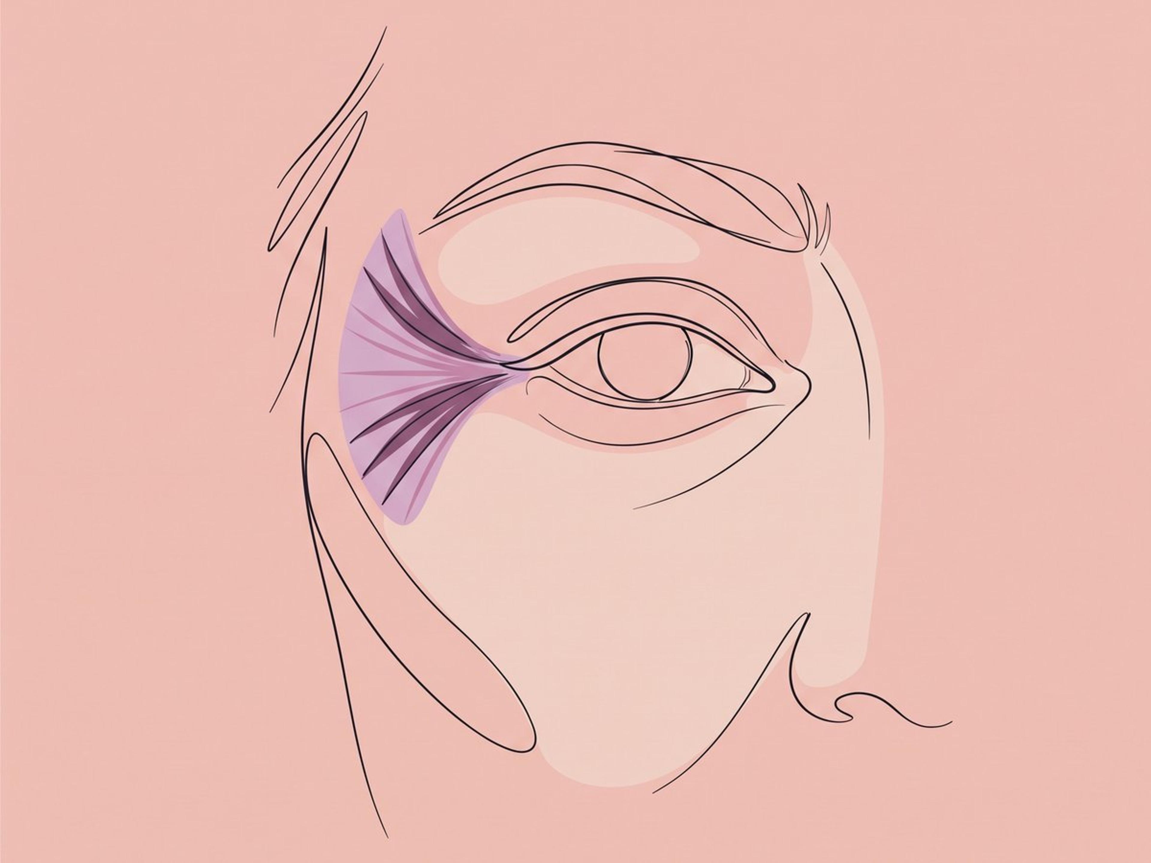 Krähenfüße — illustration