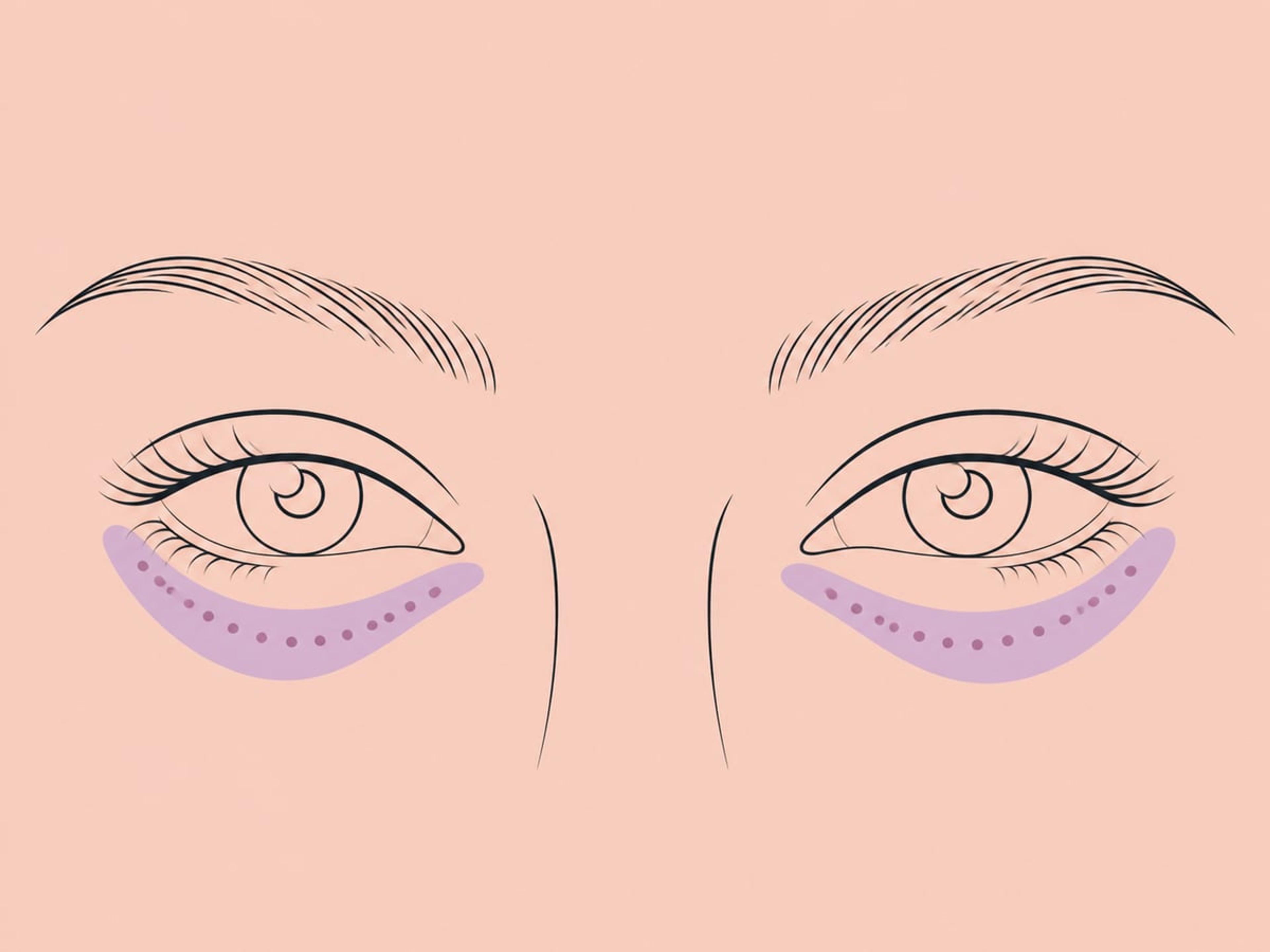 Polynukleotide (Lachs-DNA) — illustration