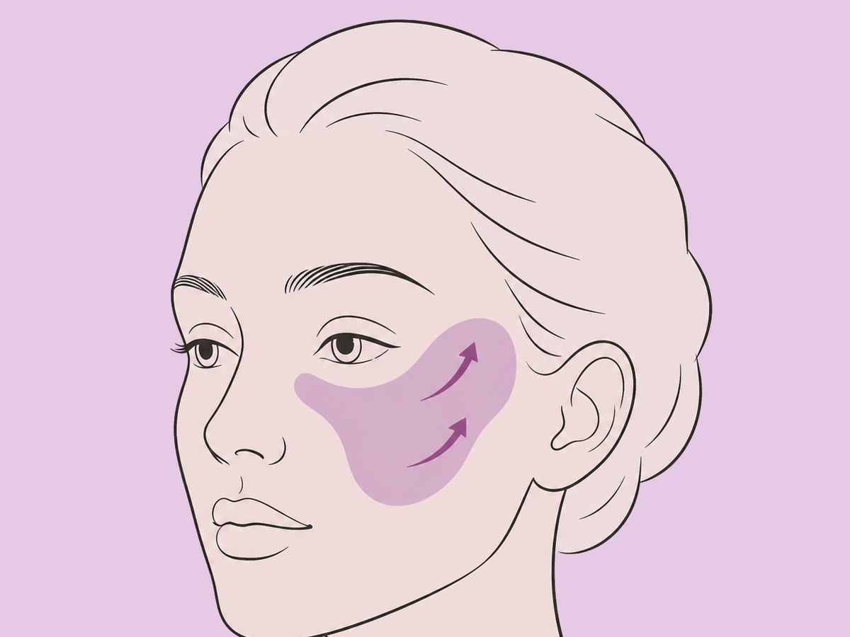Fetttransfer in Kombination mit einem Facelift — illustration