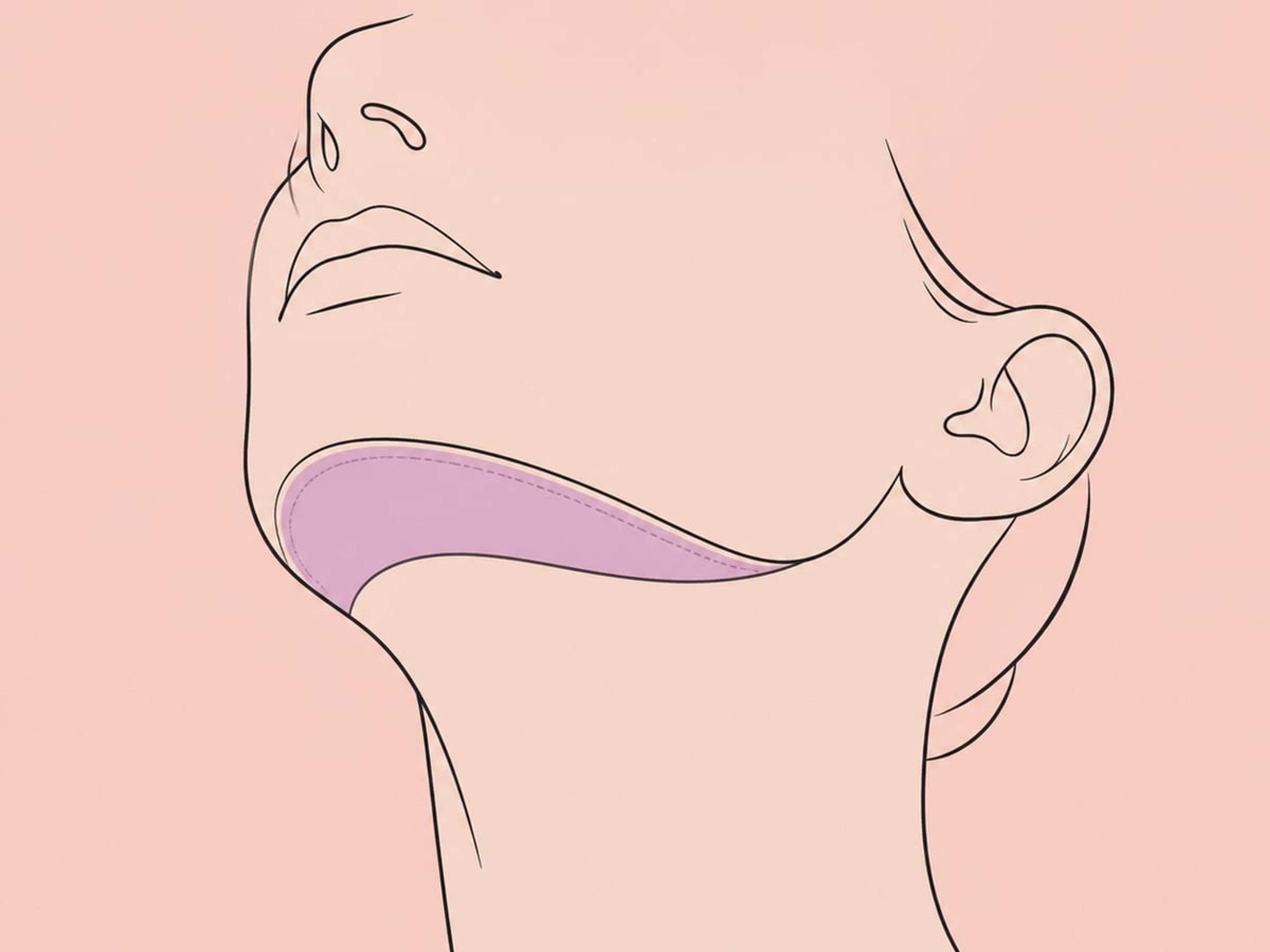 شفط دهون تحت الذقن — illustration