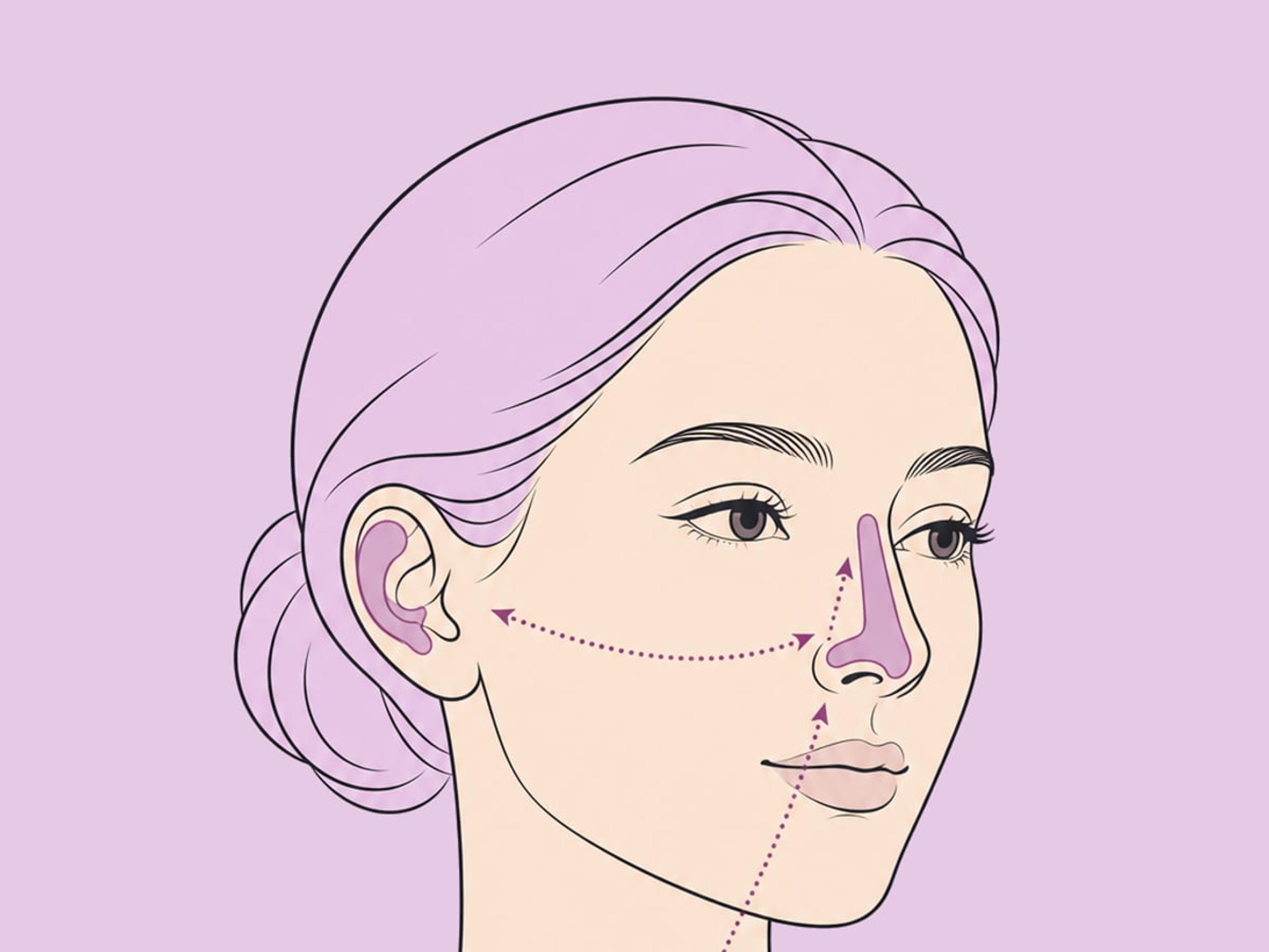 Ethnische und Revisionsrhinoplastik — illustration