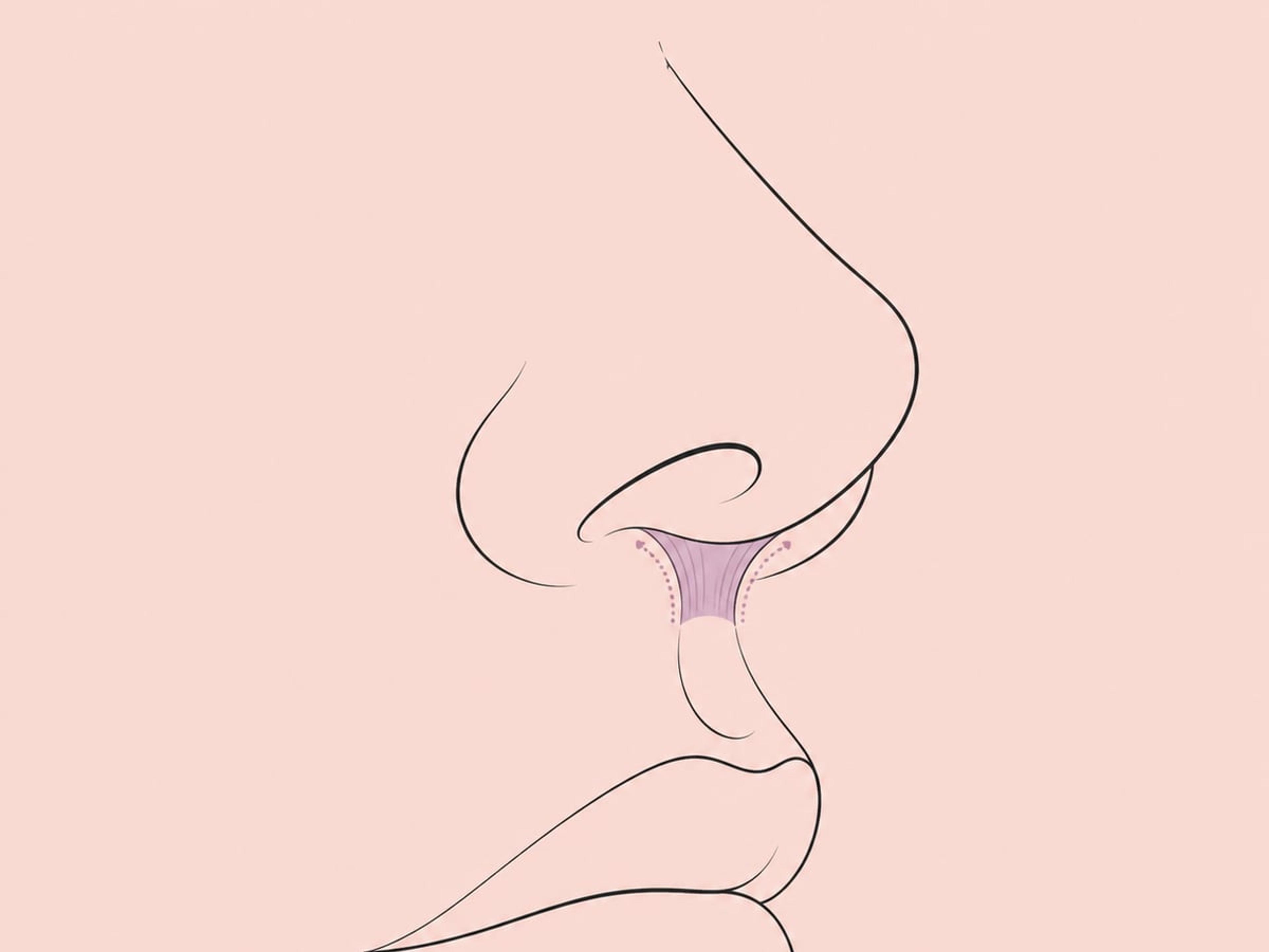 Botox-Lift der Nasenspitze — illustration