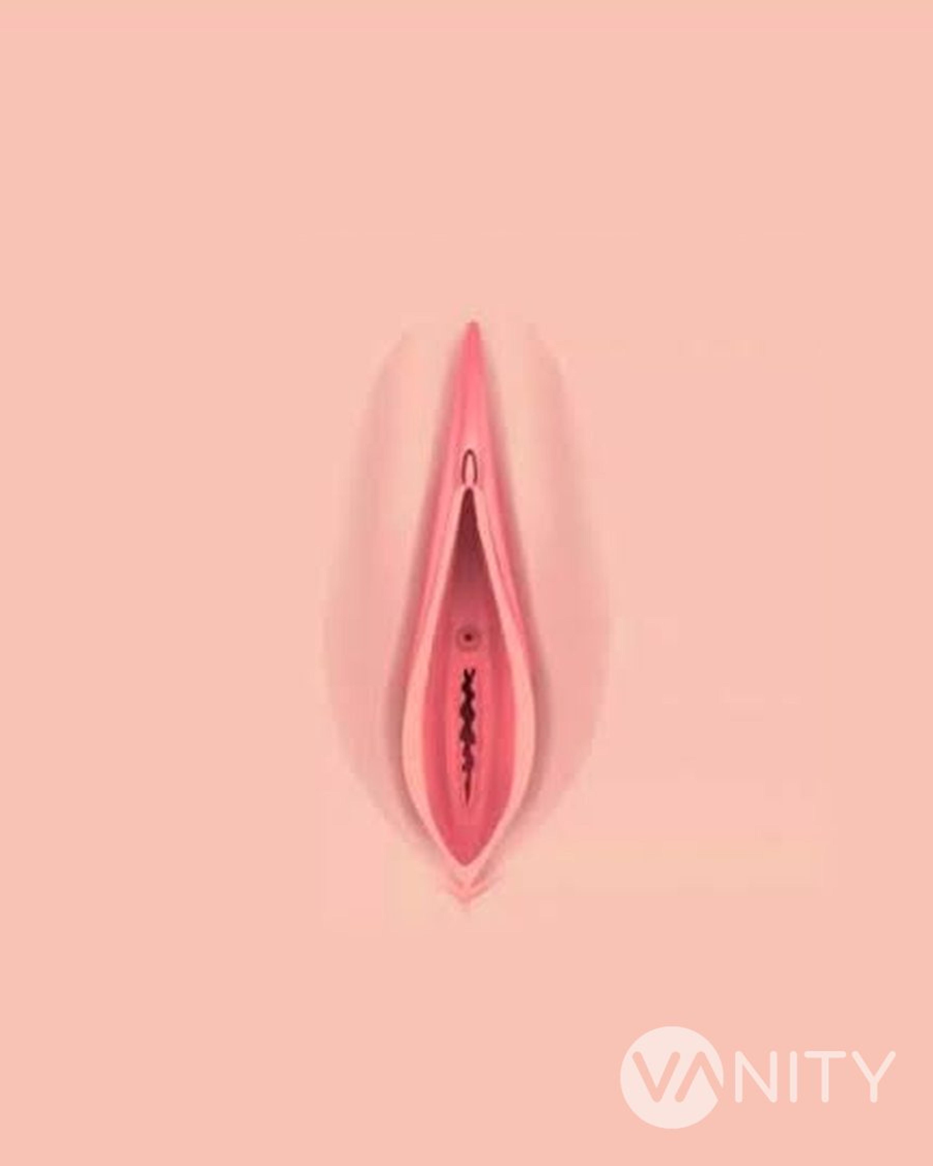 Vaginoplastik nachher, Ergebnis — Vanity, Istanbul