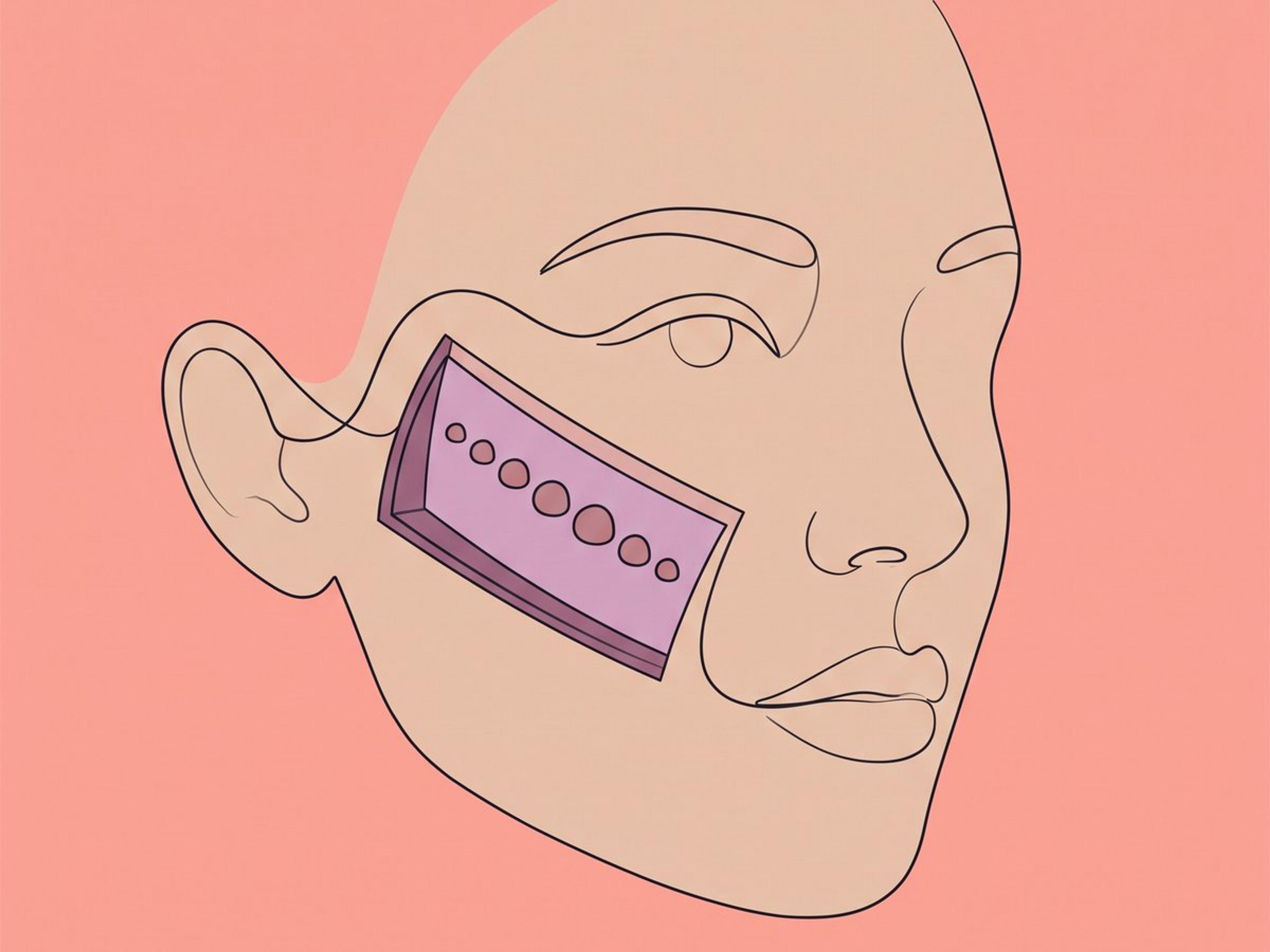 جرعات معايرة — العلاج بحسب الاستجابة — illustration