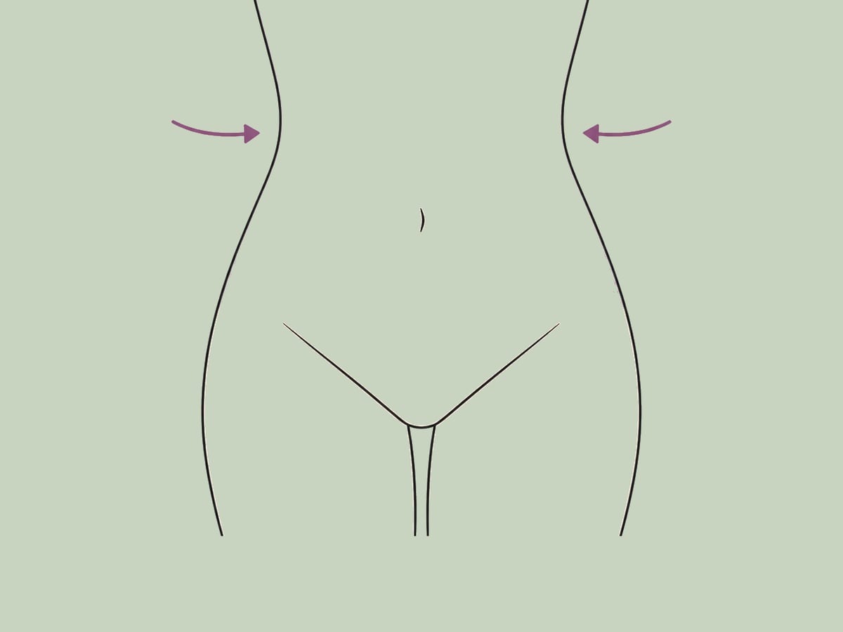Sanduhr-Bauchdeckenstraffung — illustration