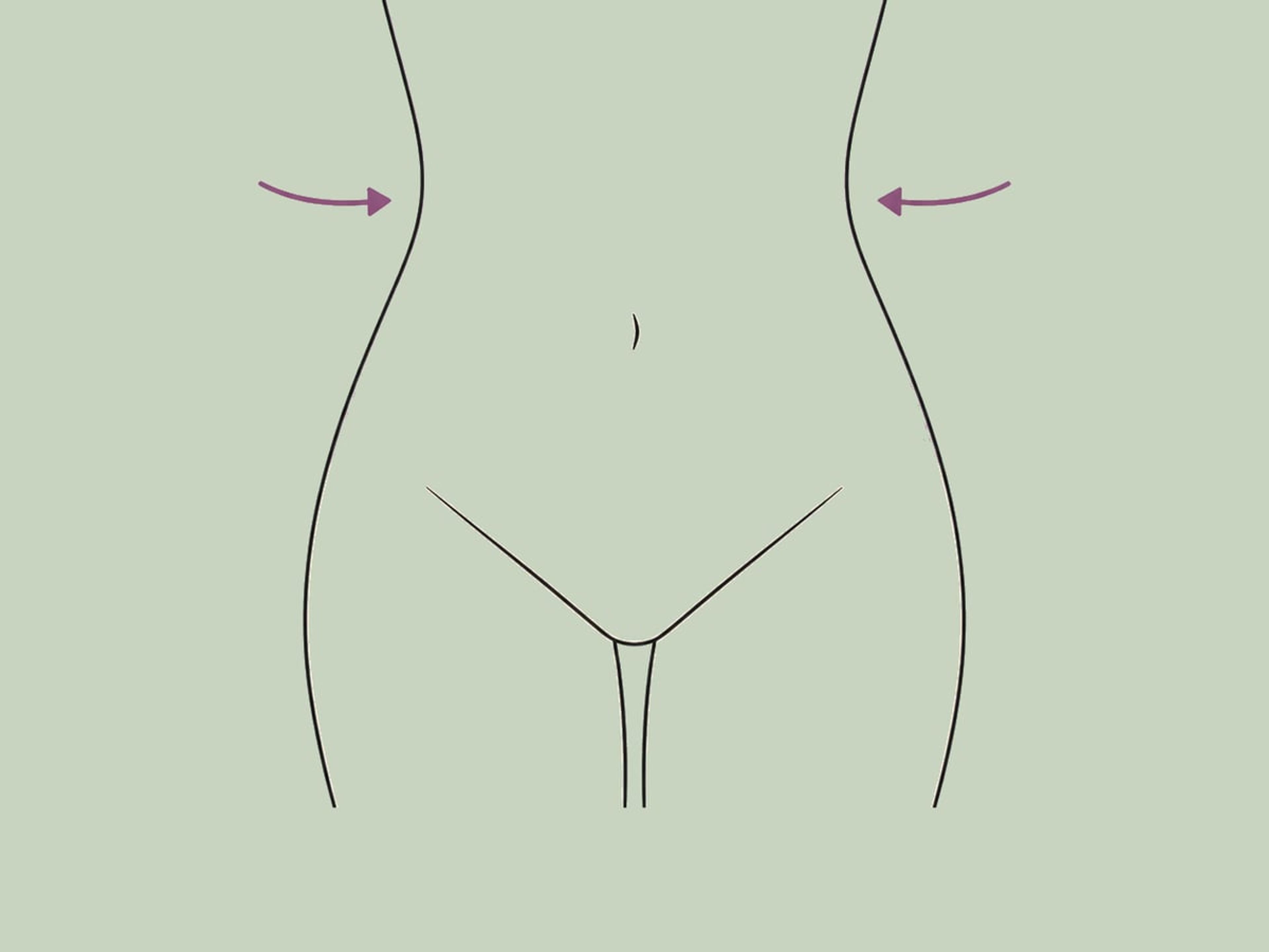 Sanduhr-Bauchdeckenstraffung — illustration
