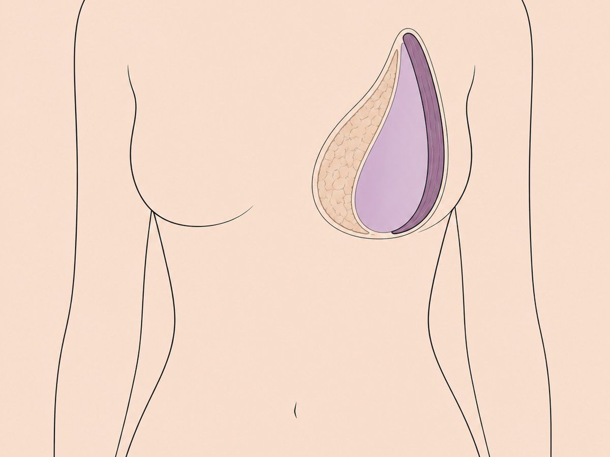 Motiva Ergonomix Implantate — illustration