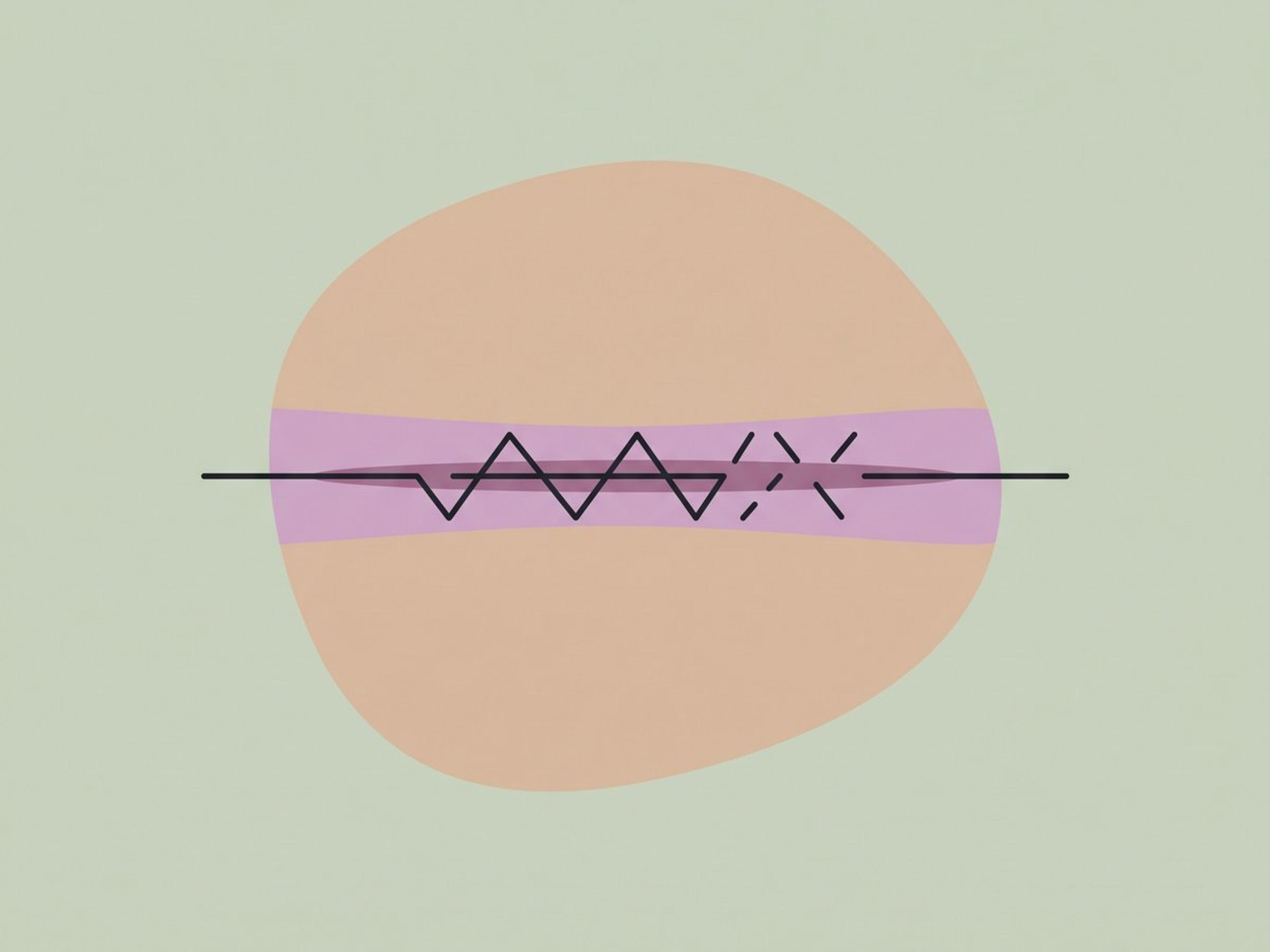W-plasty and geometric broken line closure — illustration