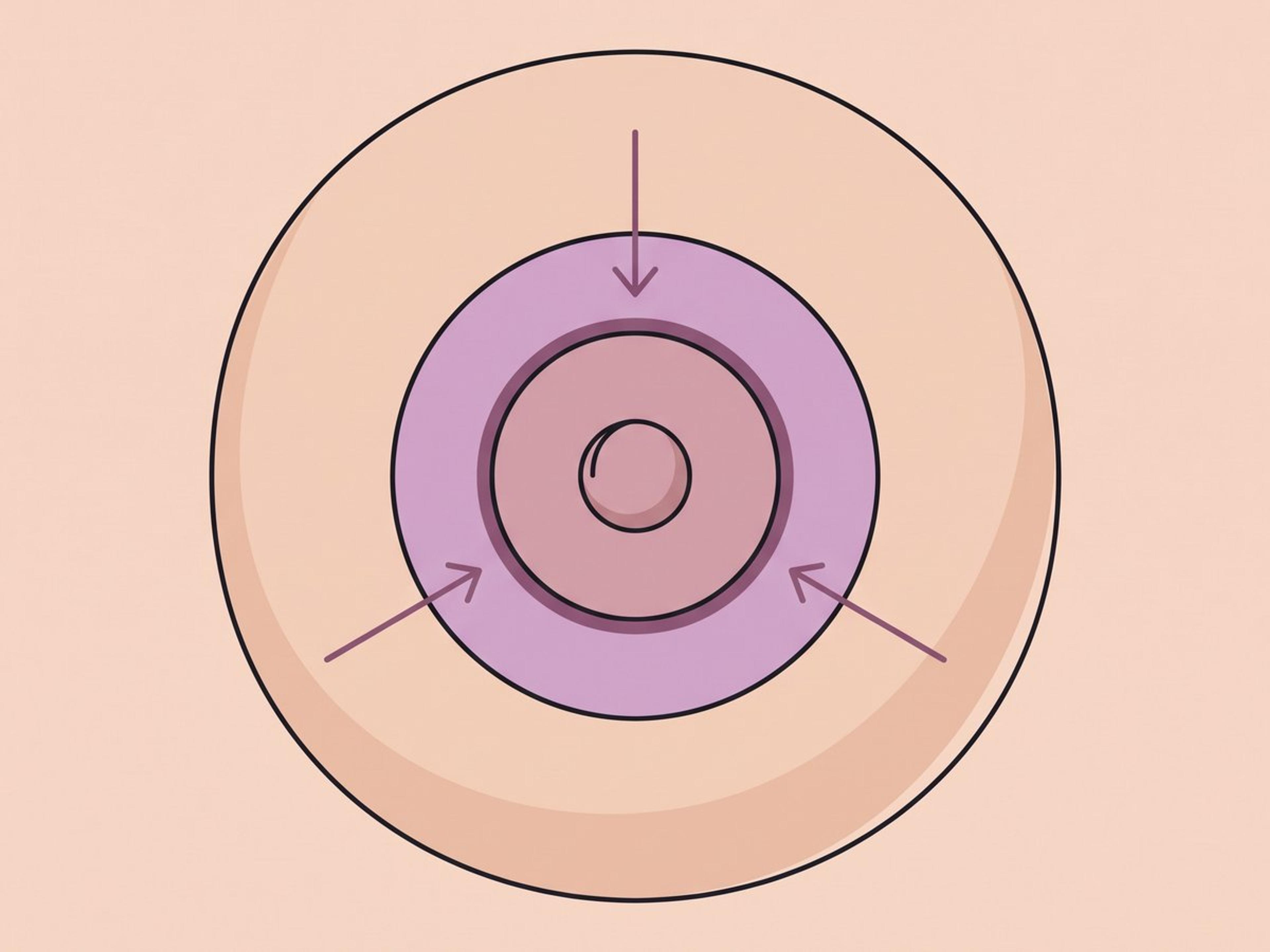 Warzenhofverkleinerung — illustration