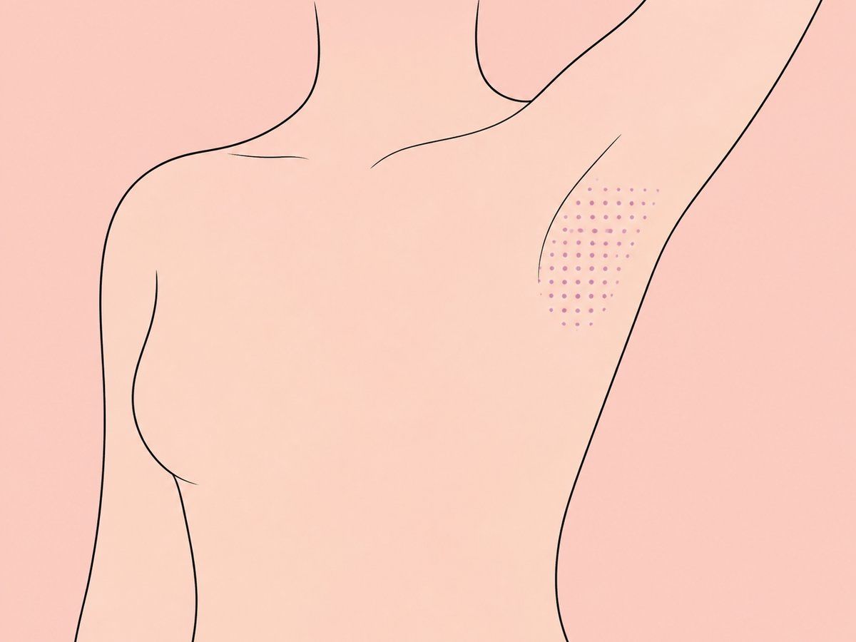 Botox bei Hyperhidrose — illustration
