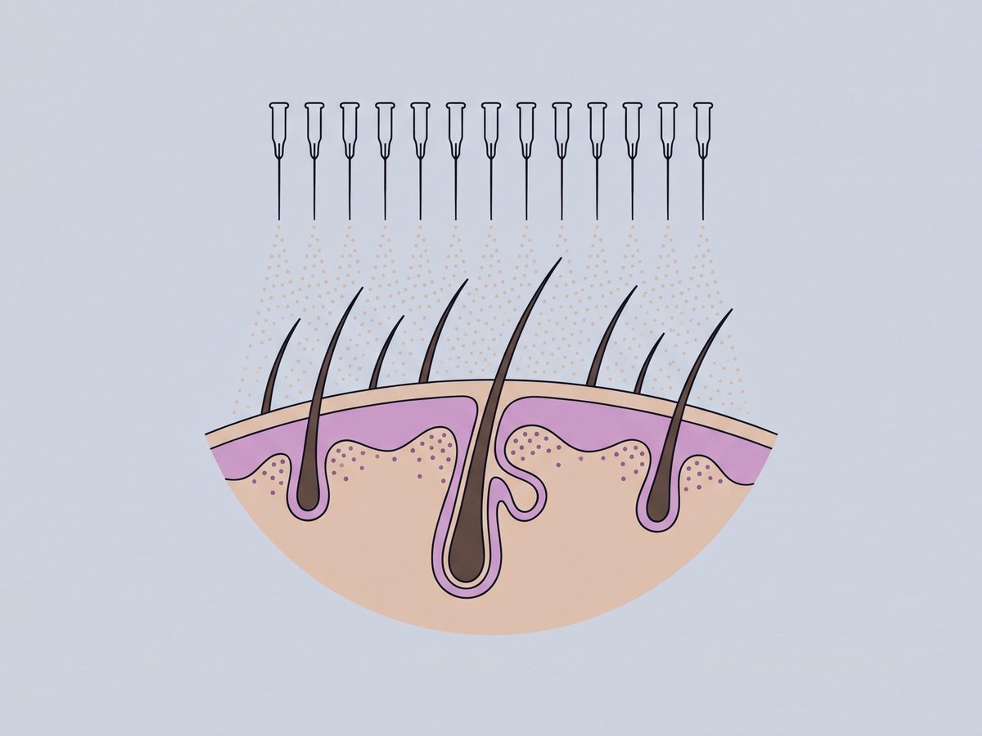 Stammzell-konditioniertes Medium (ADSC-CM) — illustration