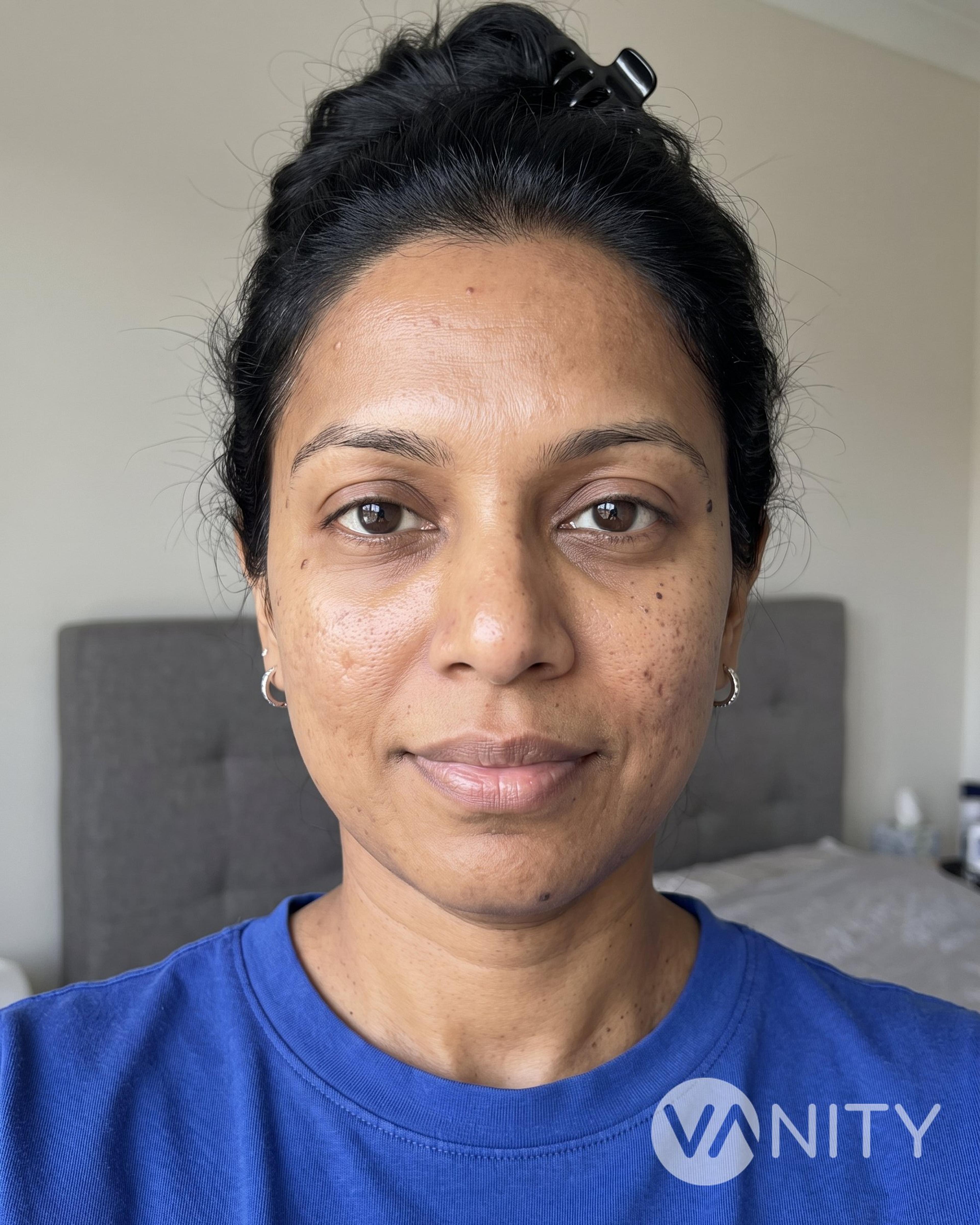 After Exosome therapy — illustrative, not a real patient