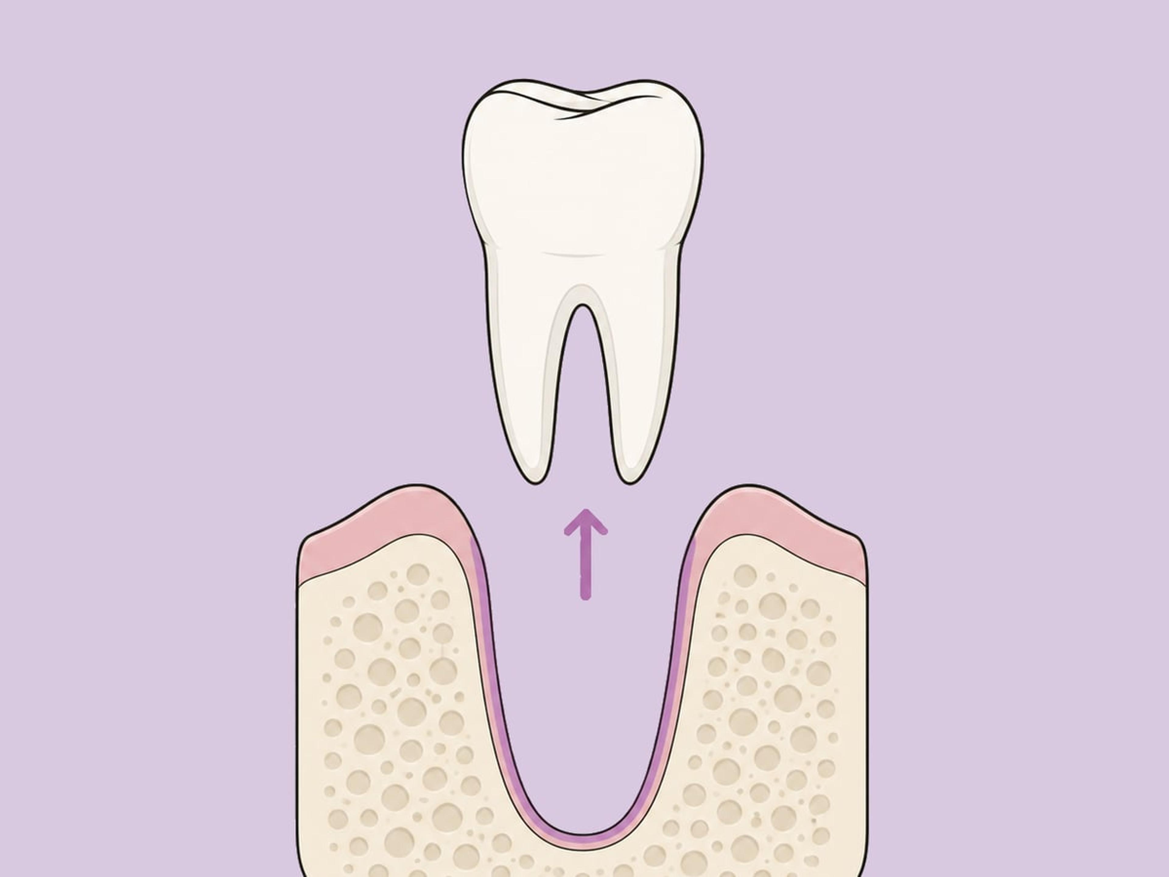 Simple (closed) extraction — illustration