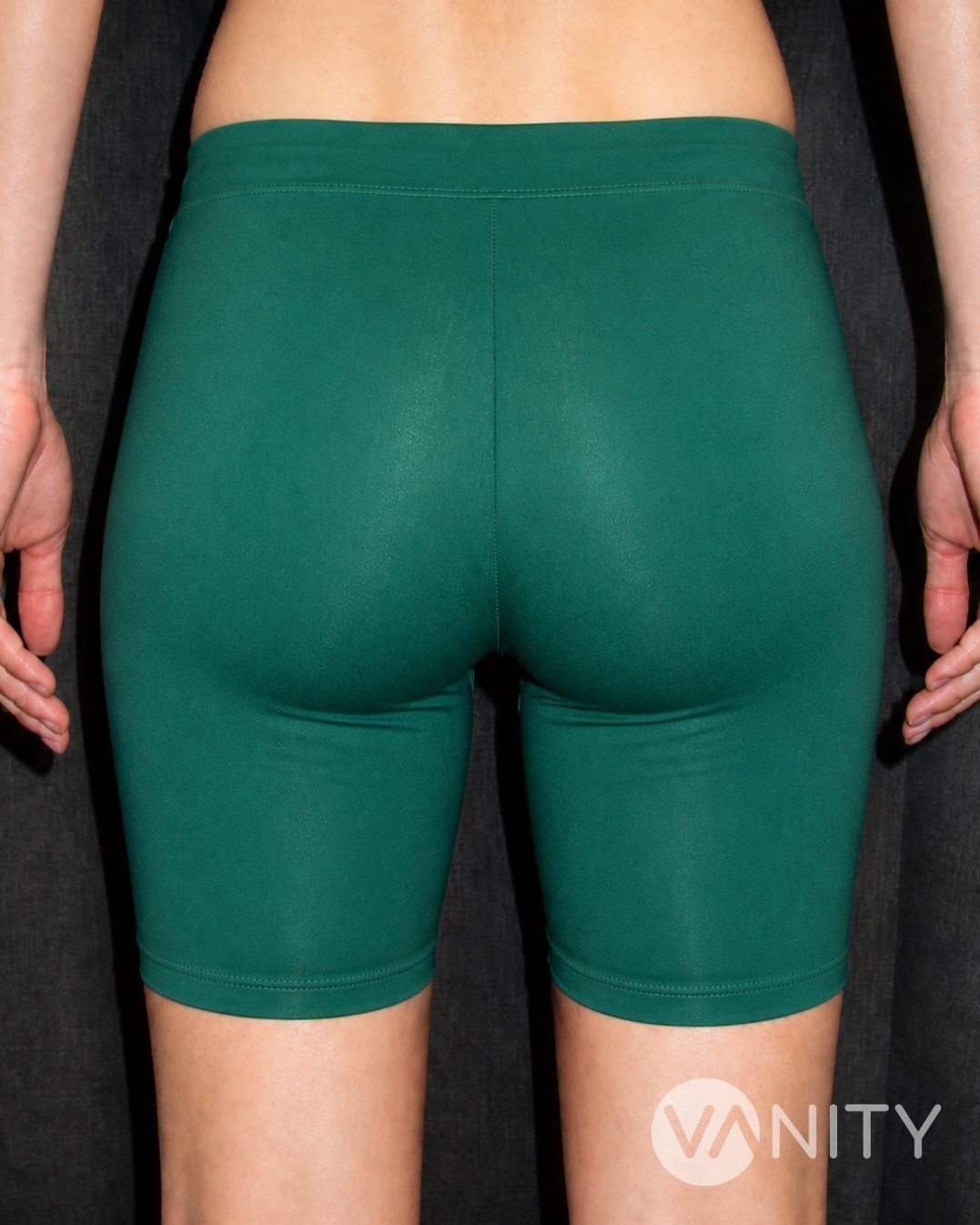 After Buttock implants — illustrative, not a real patient