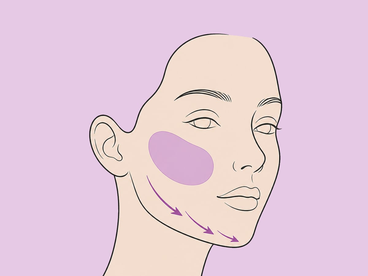 Kombiniert mit Facelift oder Kinn- und Kieferbehandlung — illustration