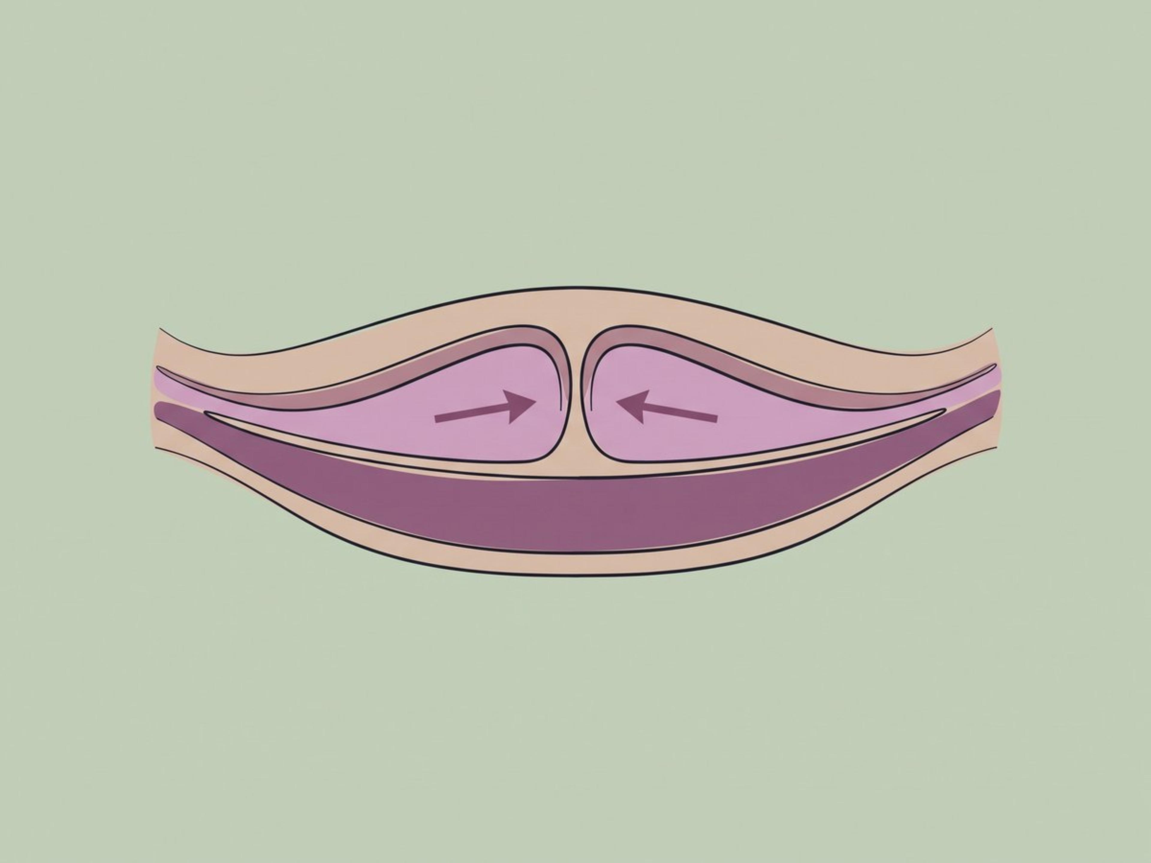 Hintere Kolporrhaphie (Vaginoplastik der hinteren Wand) — illustration