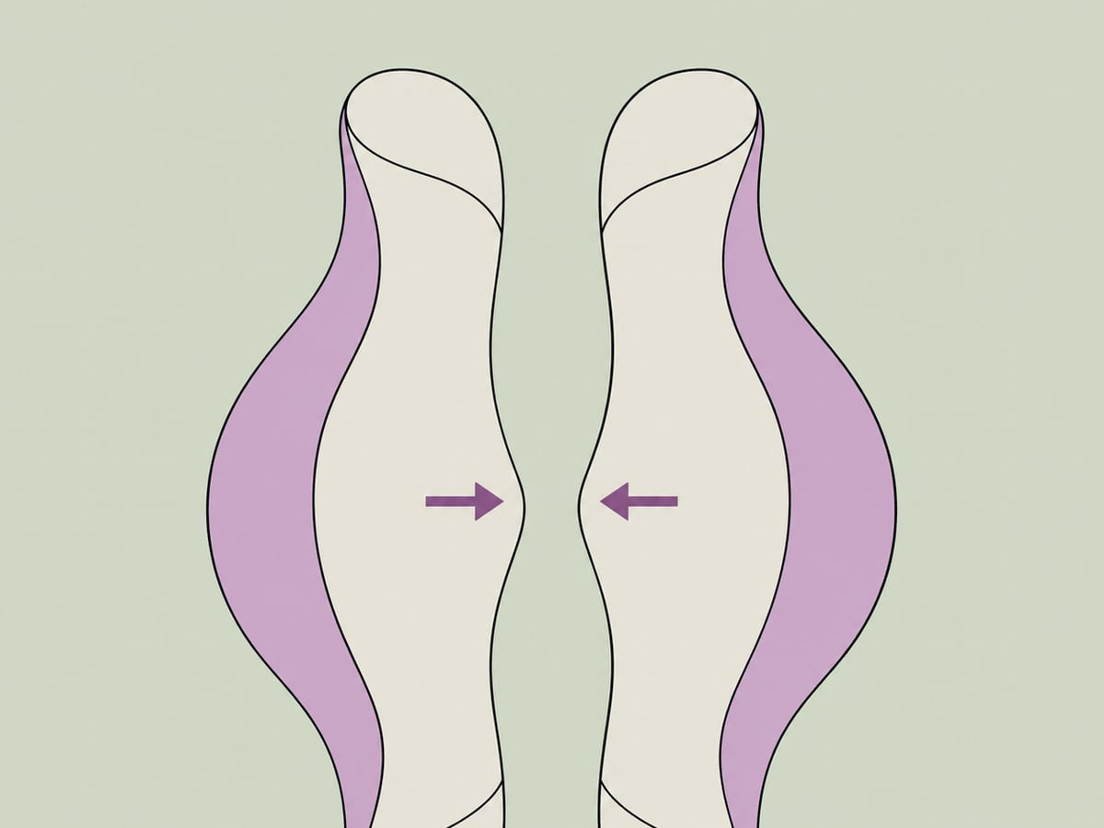 Verkleinerung der großen Schamlippen — illustration