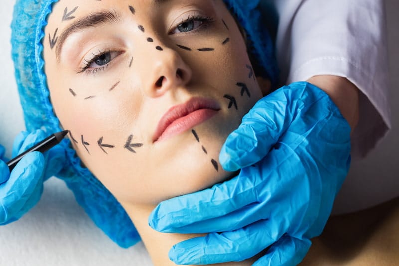 What Is the “Mar-a-Lago Face”? The New Facial Trend Defining the Trump Era