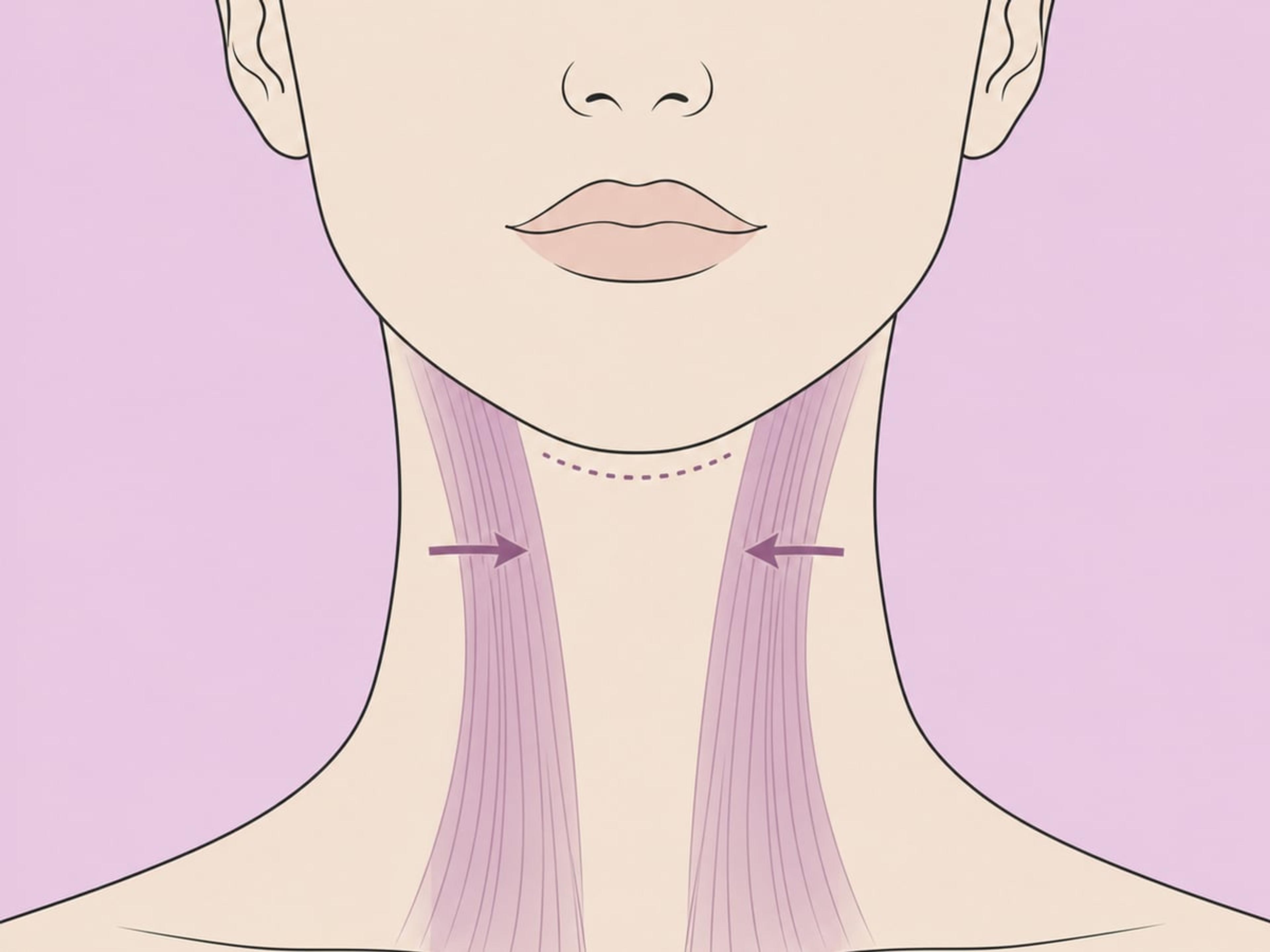 Platysmaplastik — illustration
