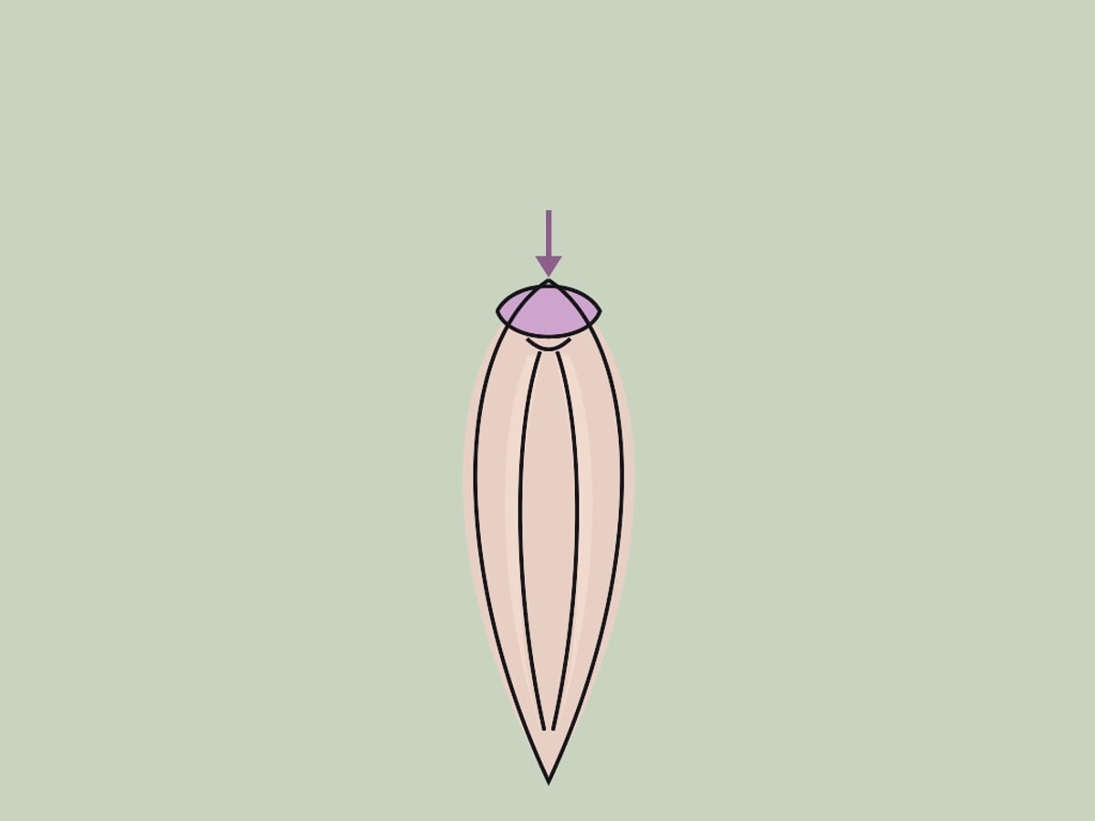 Klitorisvorhautreduktion — illustration