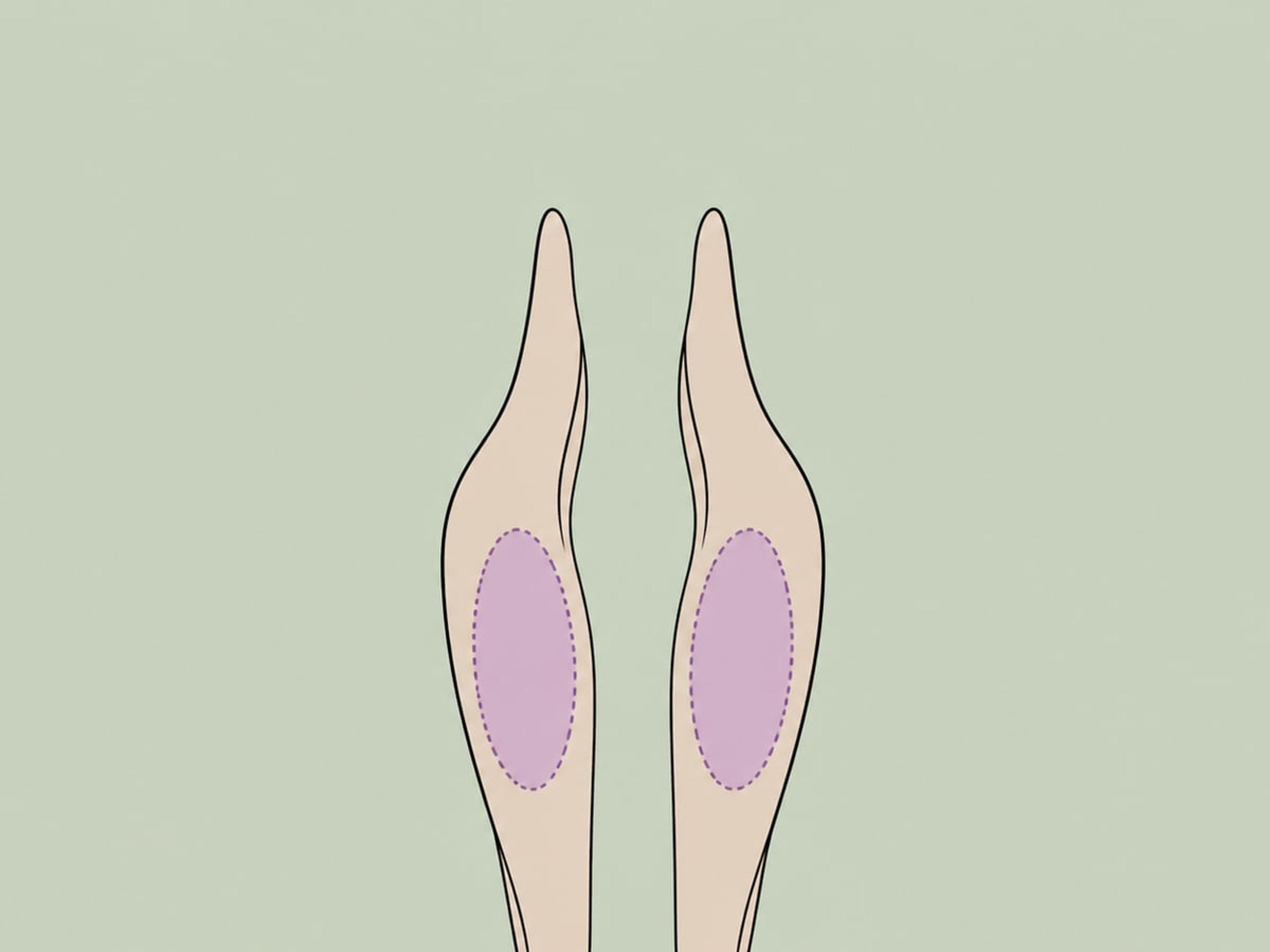 De-Epithelisierung — illustration