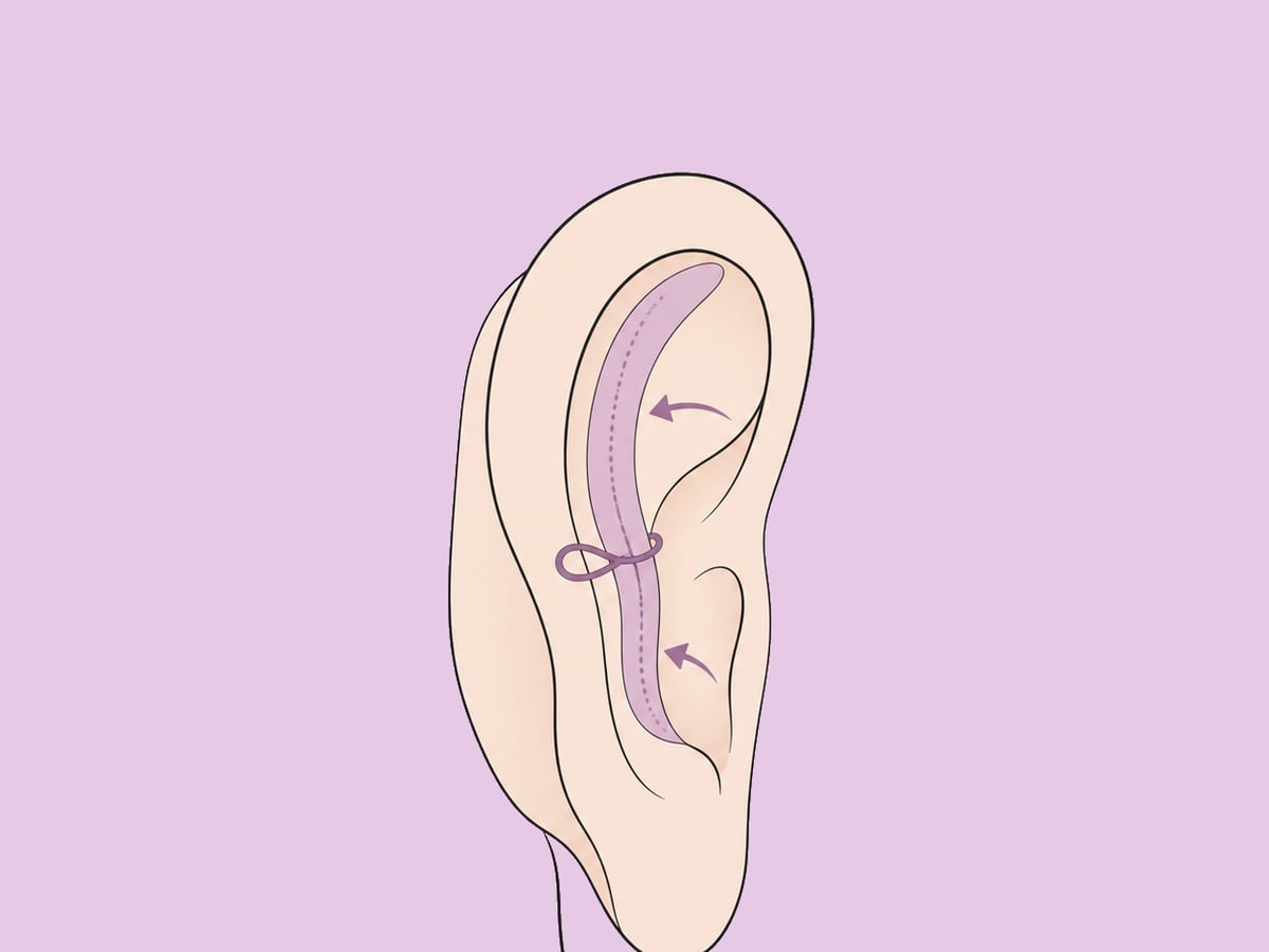 Kombinierter Ansatz — illustration